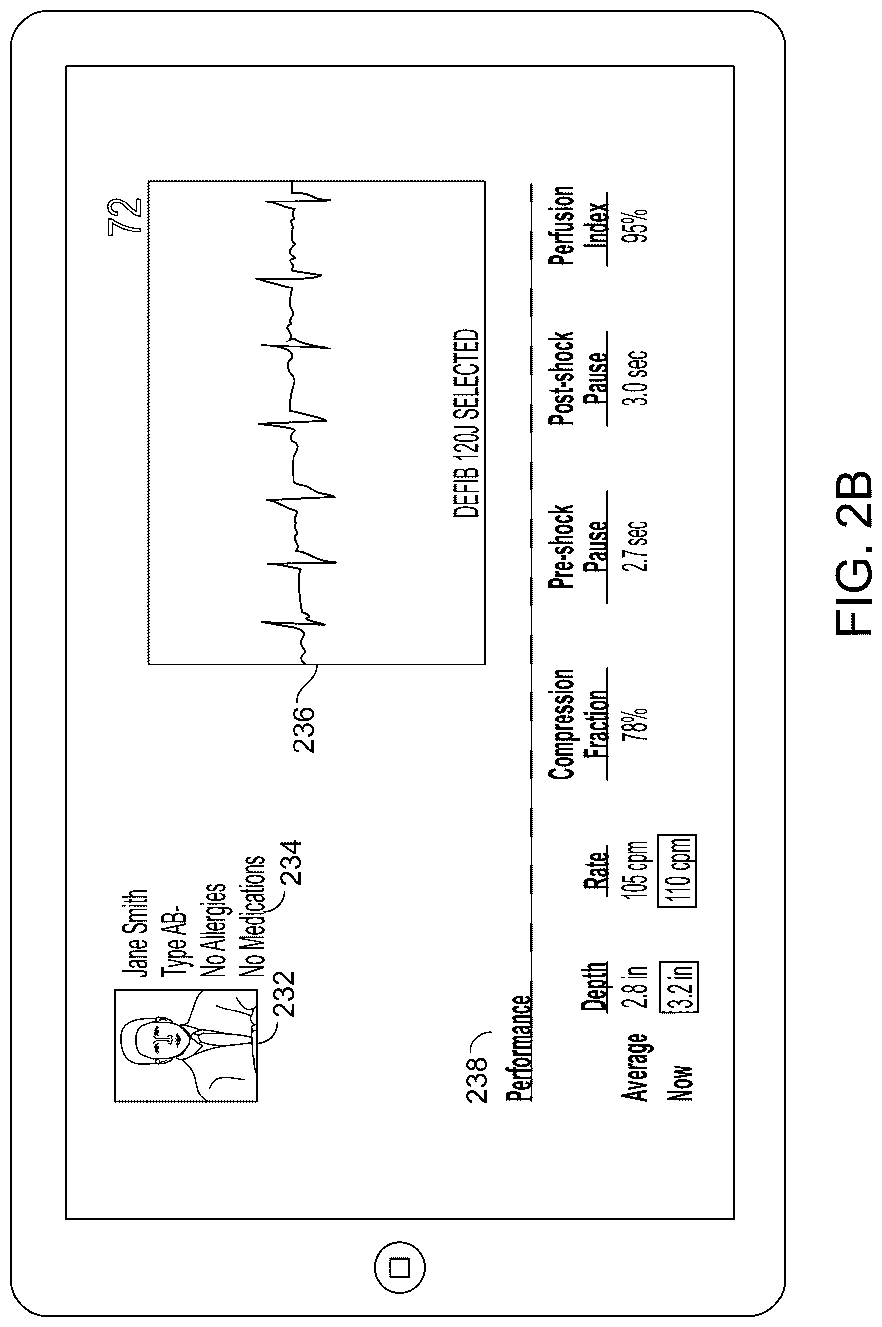 Patent US12100503 Figure 4 – Rescue performance metrics for CPR and traumatic brain injury