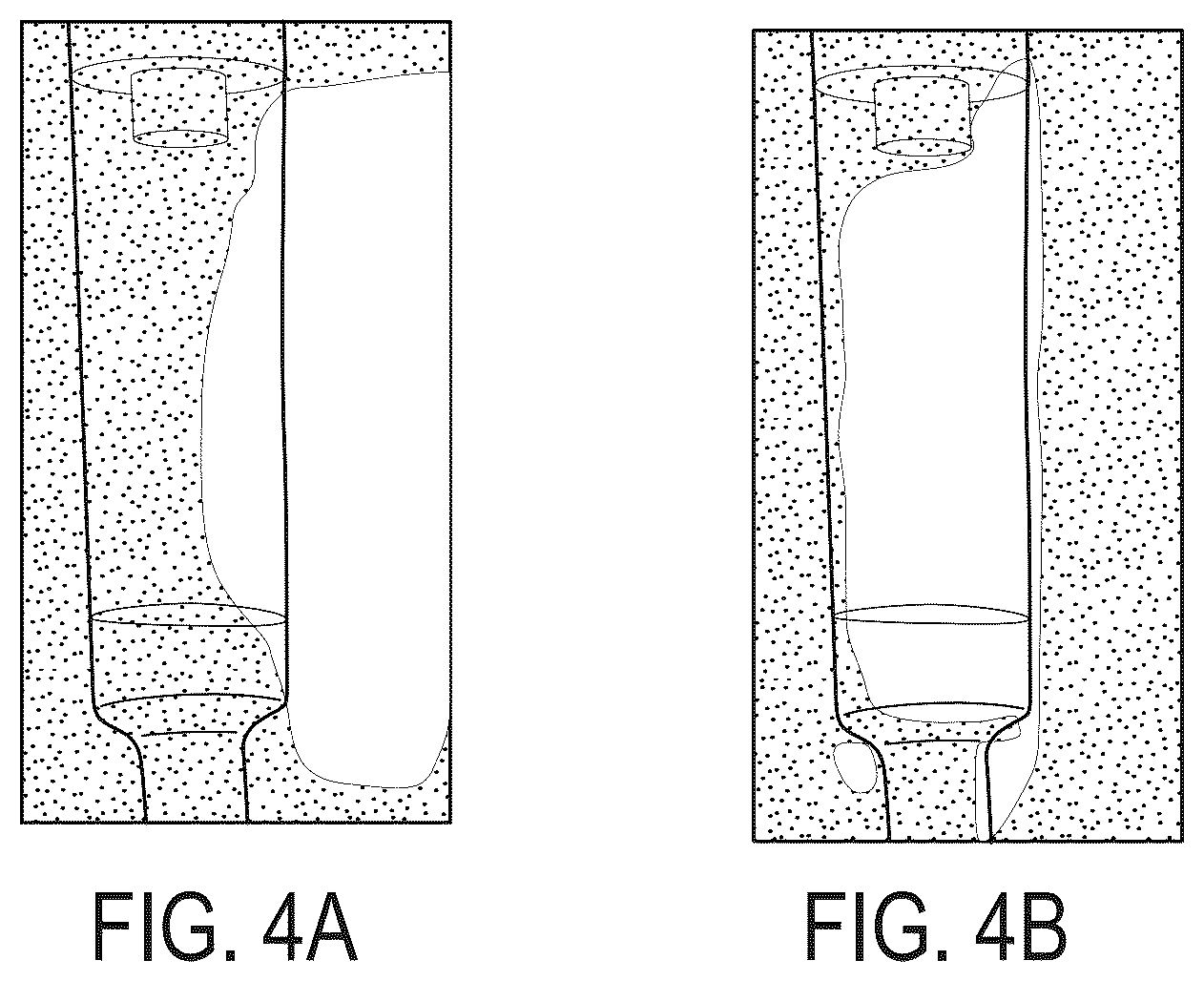 Patent US12100507 Figure 4 – System, method, and apparatus for monitoring, regulating, or controlling fluid flow