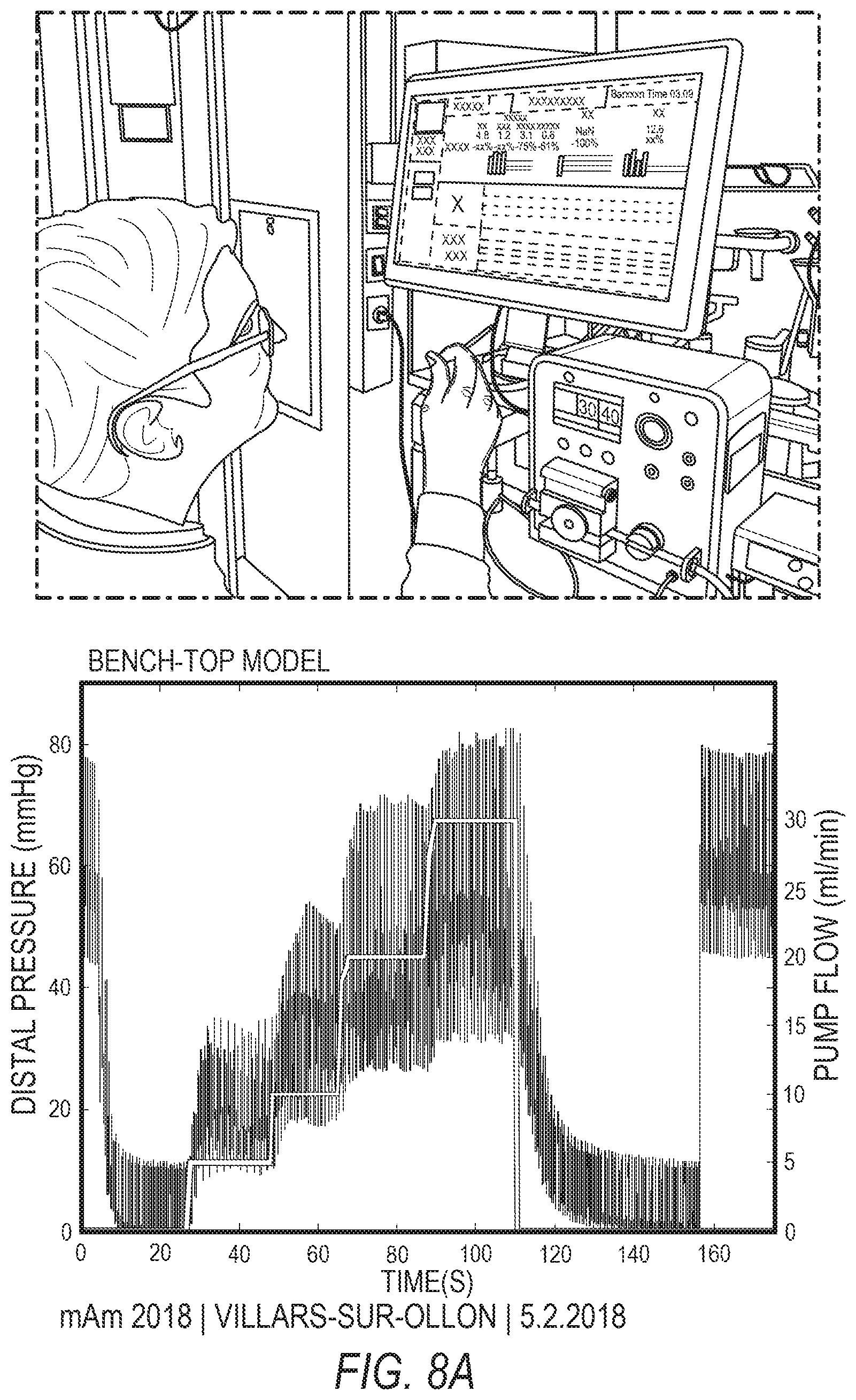 Patent US12100516 Figure 9 – Microfluidic coronary circulatory model