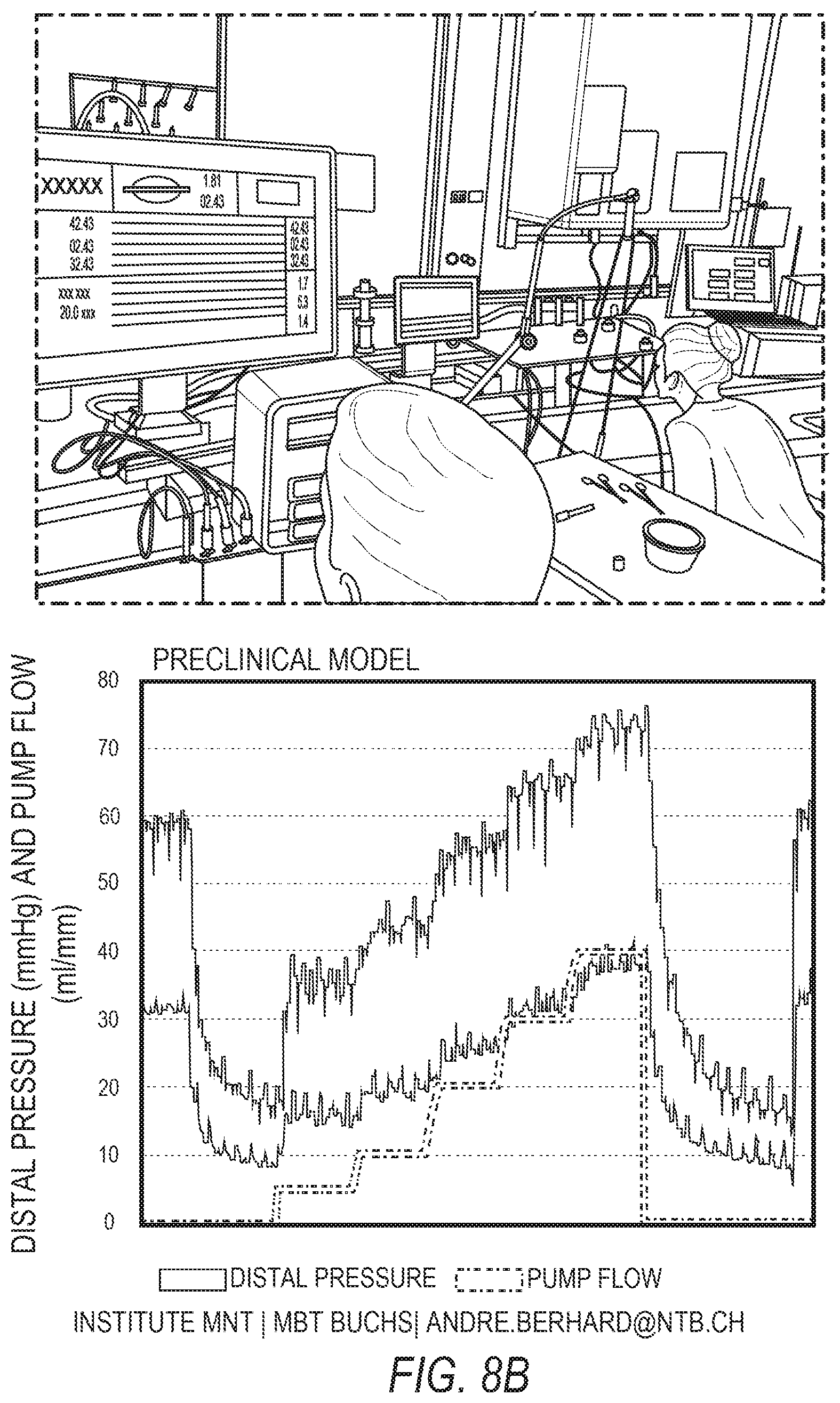 Patent US12100516 Figure 10 – Microfluidic coronary circulatory model