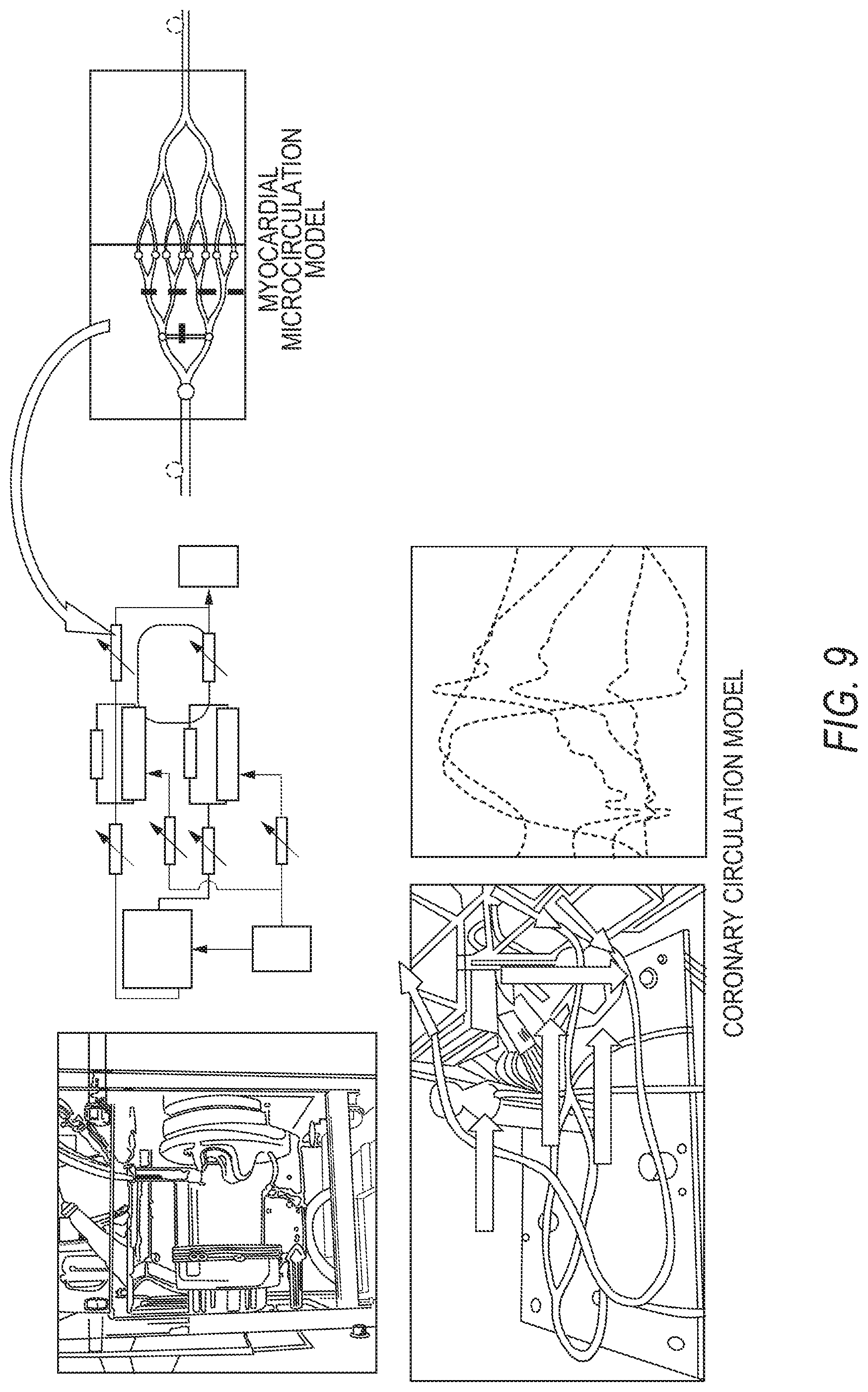 Patent US12100516 Figure 11 – Microfluidic coronary circulatory model