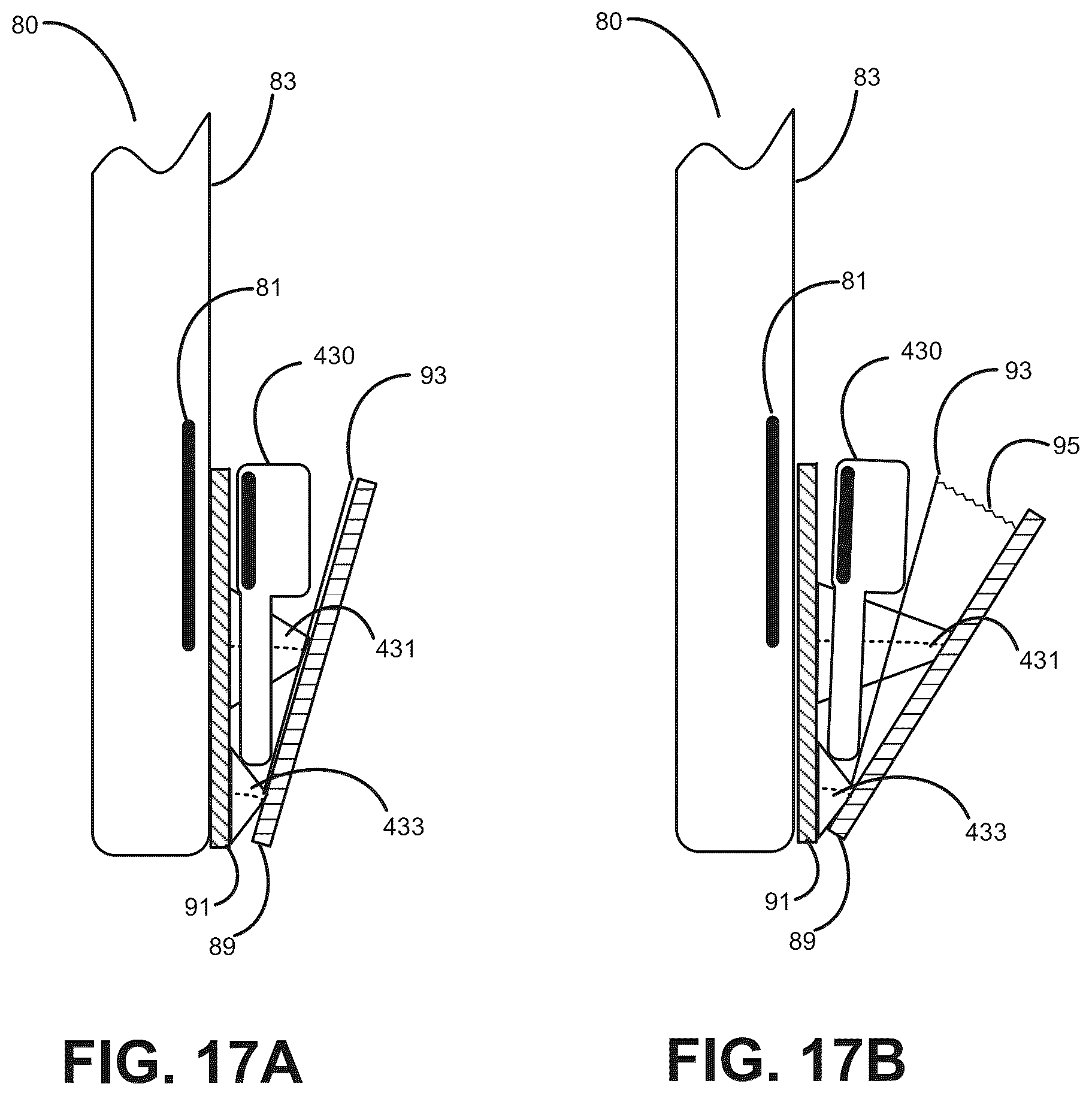 Patent US12100983 Figure 17 – Wireless power transfer system for listening devices with expandable case