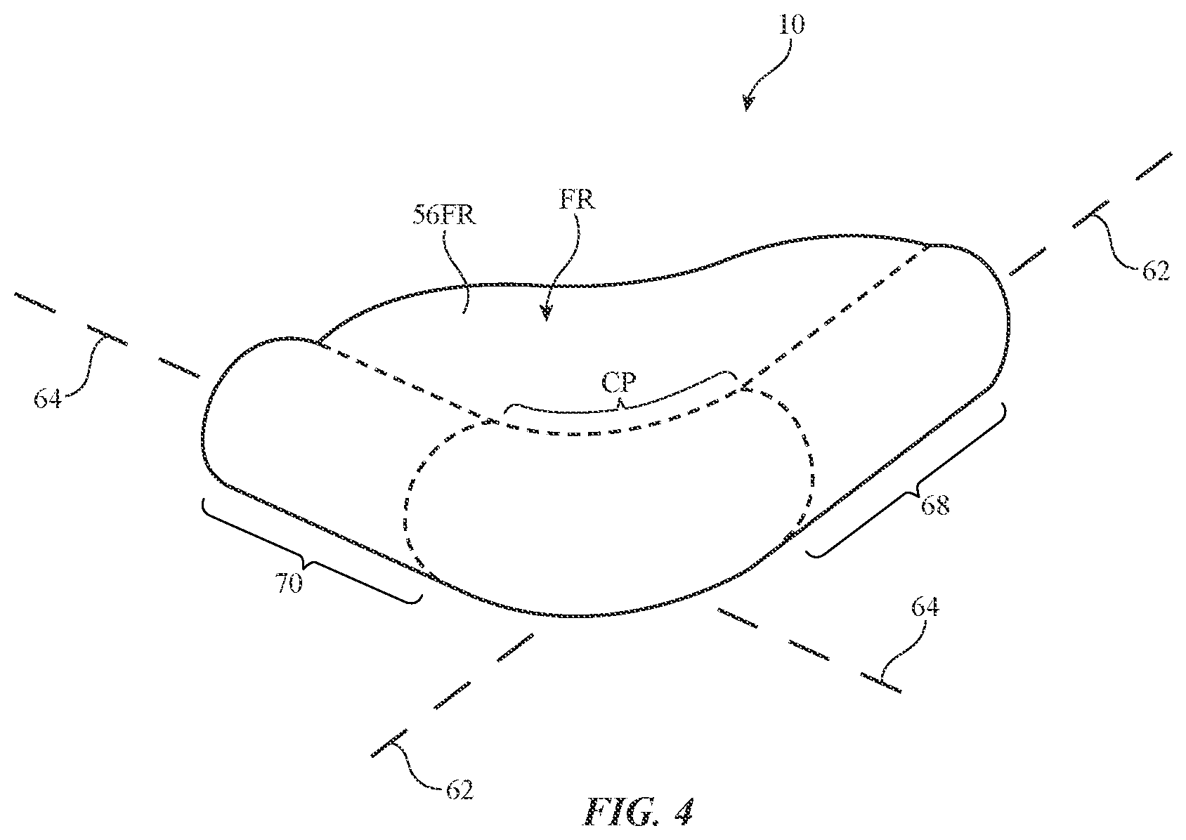 Patent US12101426 Figure 4 – Electronic devices having vertical image transport layers