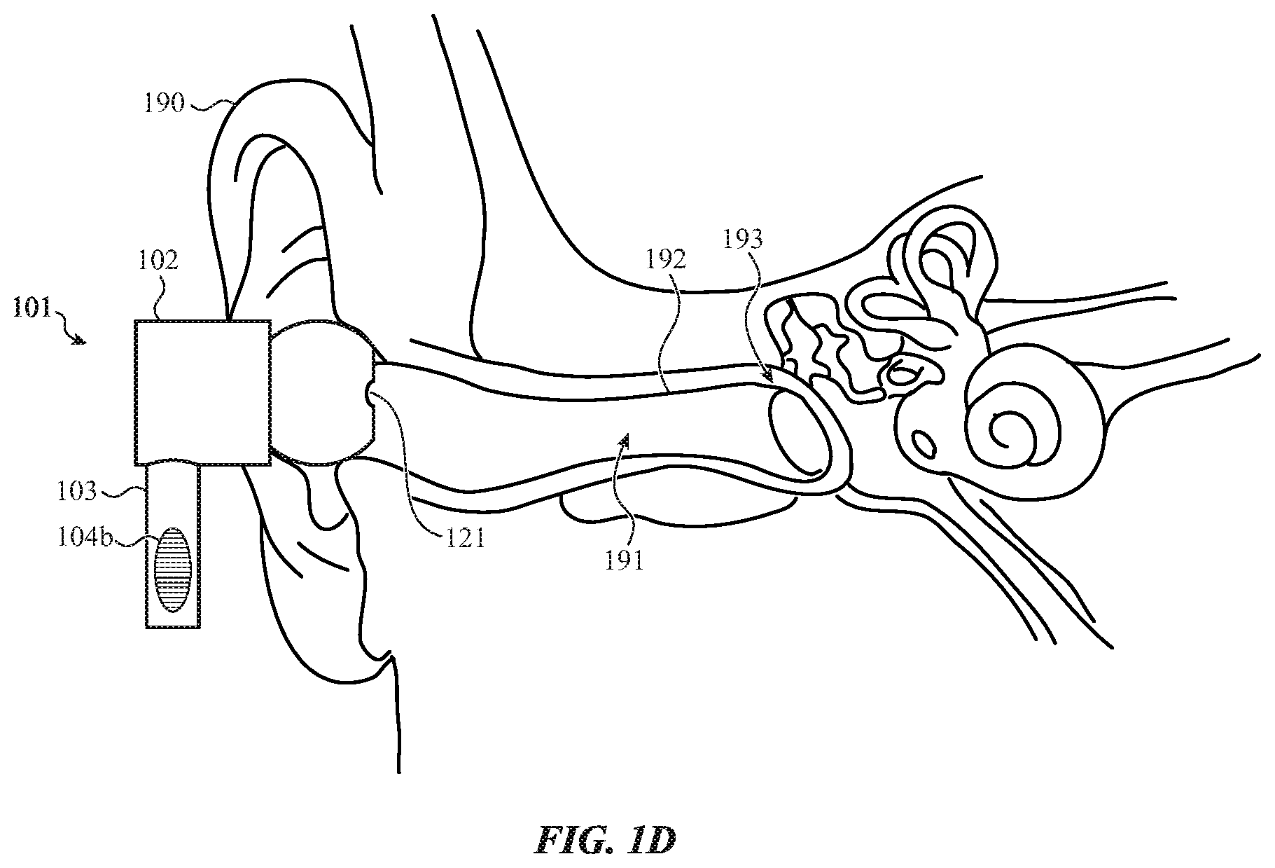 Patent US12101590 Figure 4 – Force-activated earphone