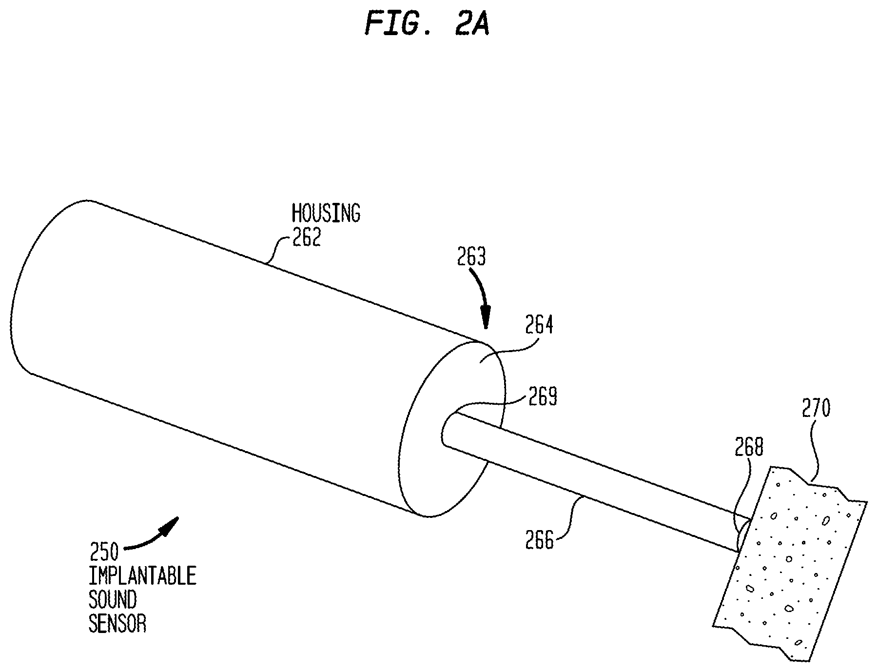 Patent US12101602 Figure 3 – Implantable sound sensors with non-uniform diaphragms