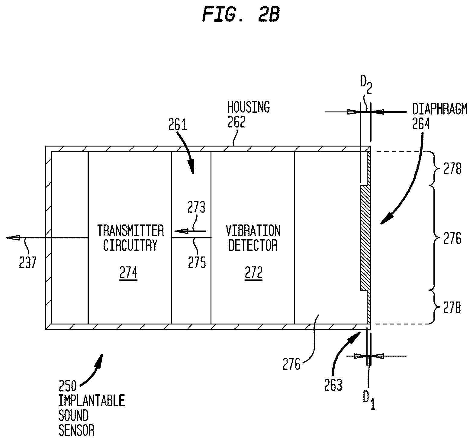Patent US12101602 Figure 4 – Implantable sound sensors with non-uniform diaphragms