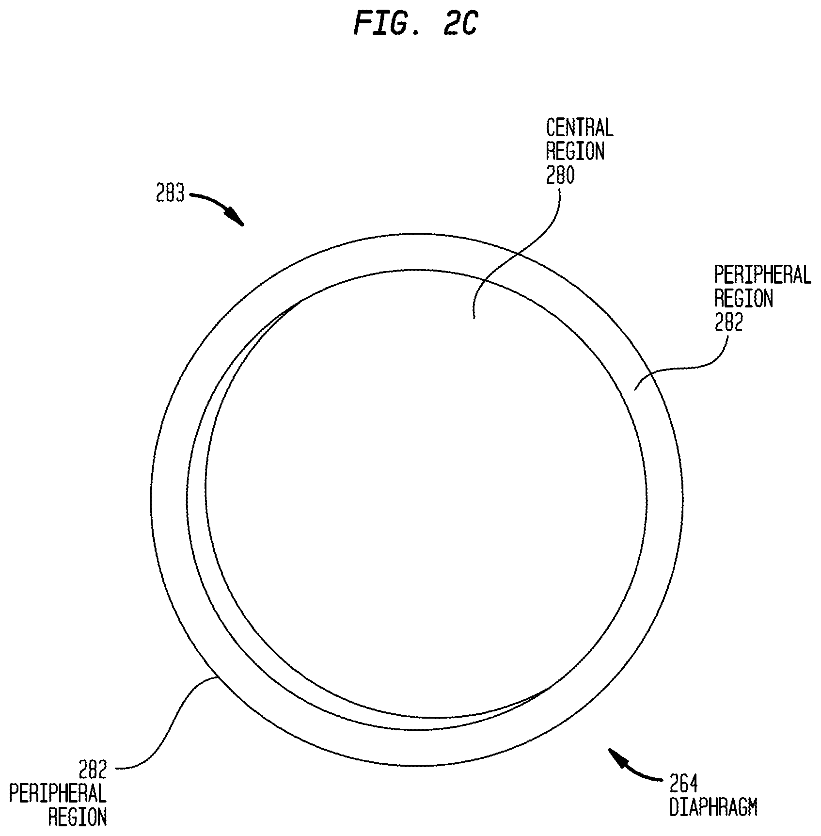 Patent US12101602 Figure 5 – Implantable sound sensors with non-uniform diaphragms