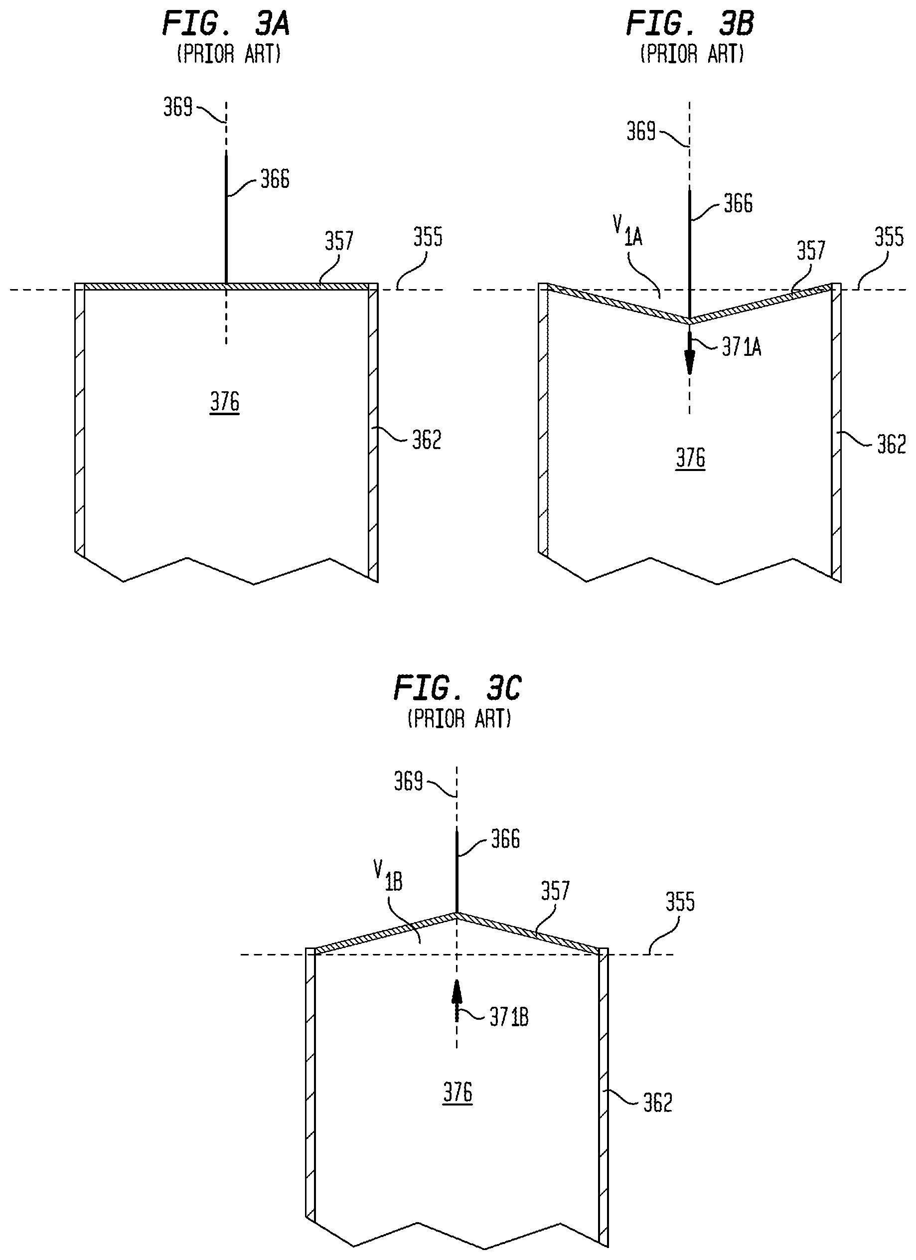 Patent US12101602 Figure 6 – Implantable sound sensors with non-uniform diaphragms