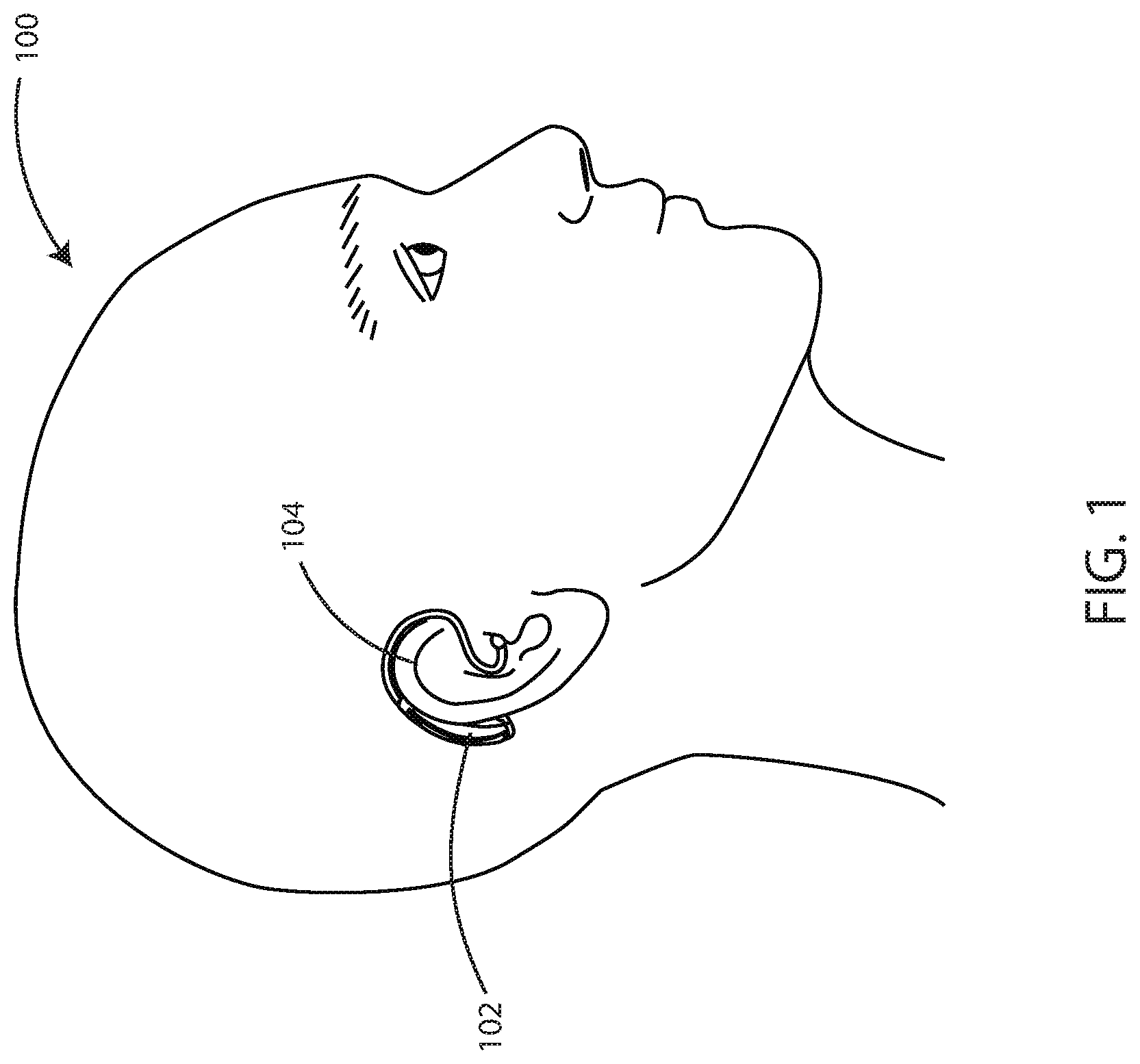 Patent US12101604 Figure 1 – Systems, devices and methods for fitting hearing assistance devices