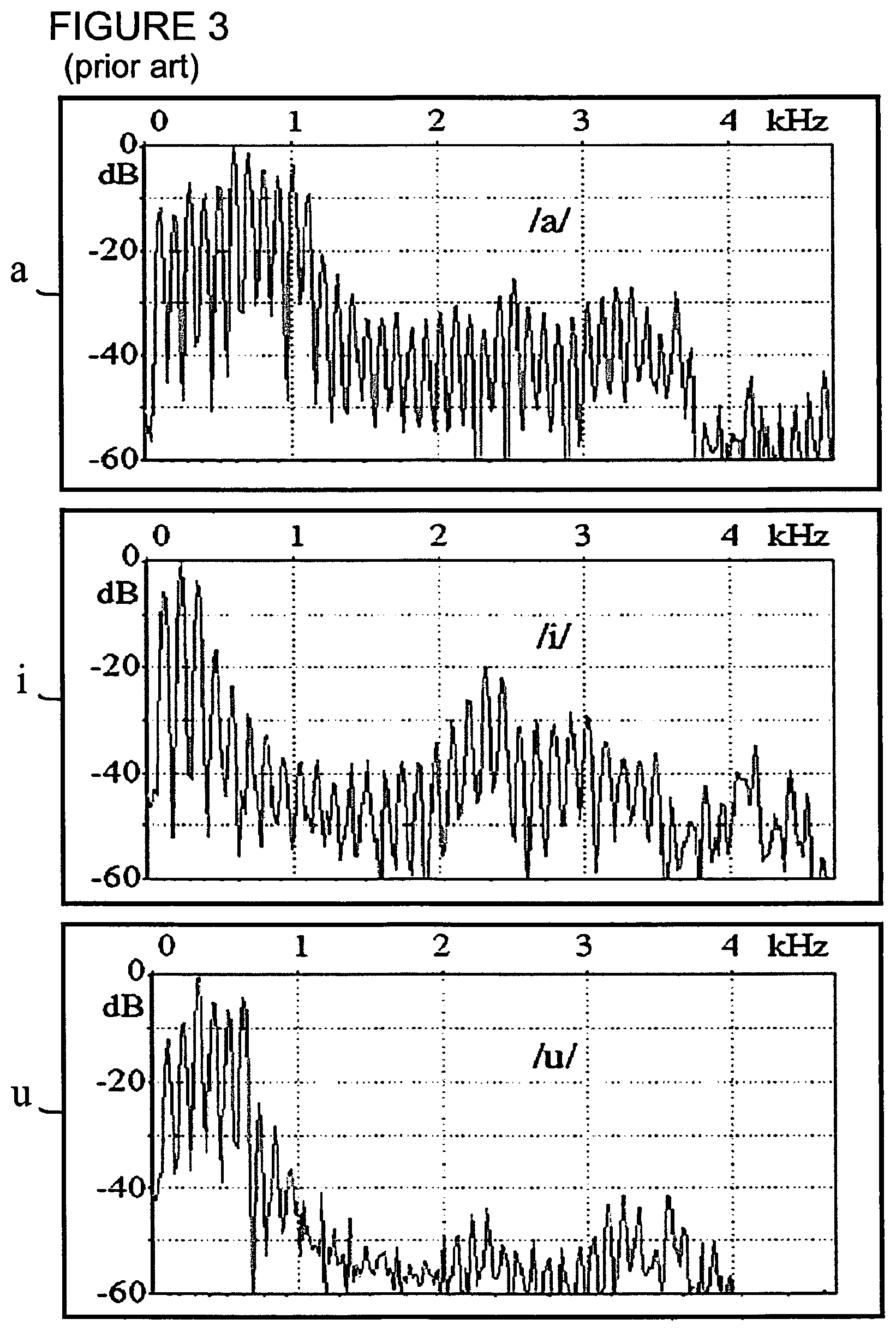 Patent US12101605 Figure 3 – Adaptive hearing normalization and correction system with automatic tuning