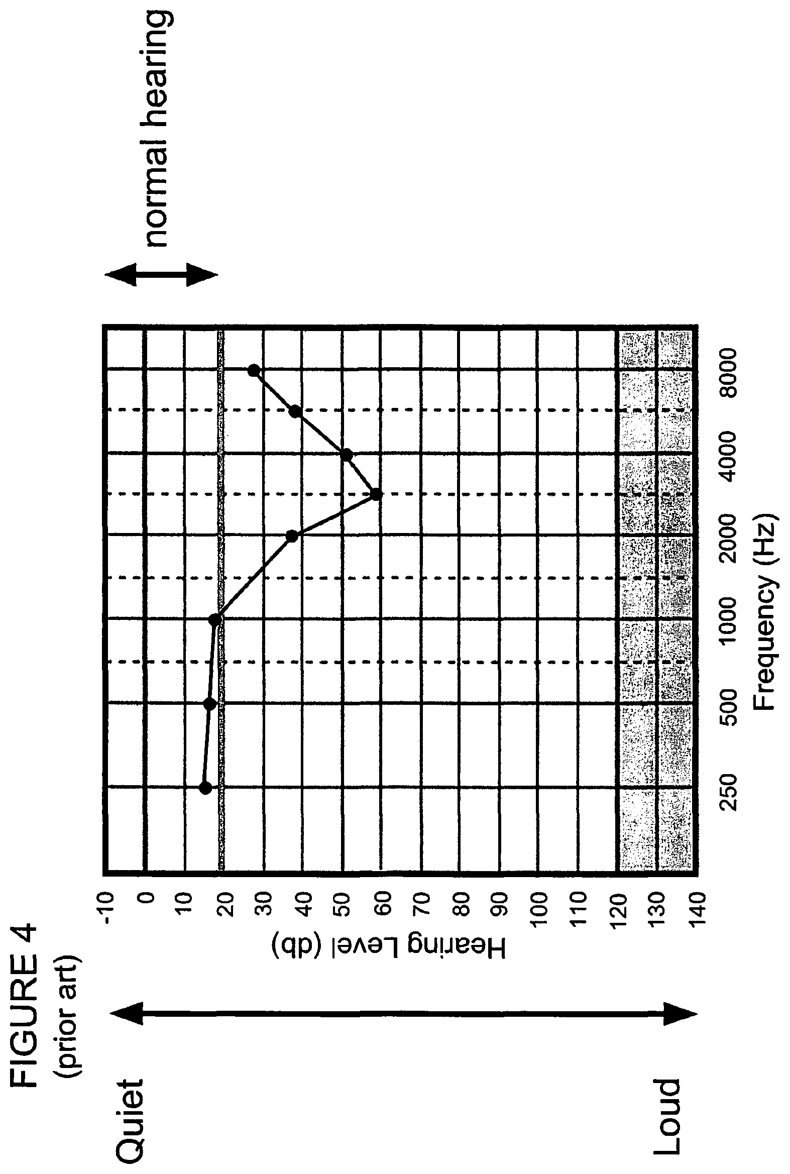 Patent US12101605 Figure 4 – Adaptive hearing normalization and correction system with automatic tuning