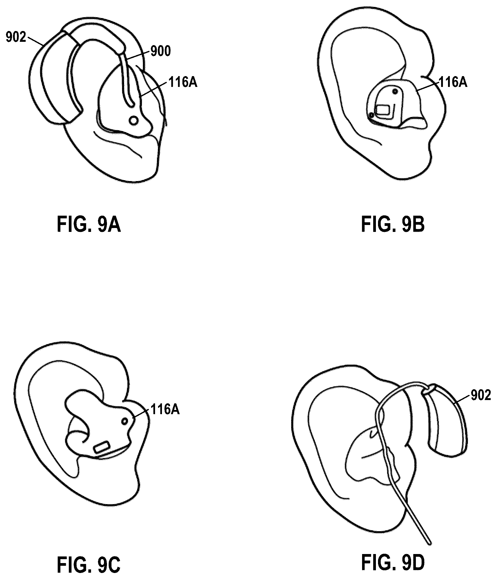 Patent US12101606 Figure 9 – Methods and systems for assessing insertion position of hearing instrument