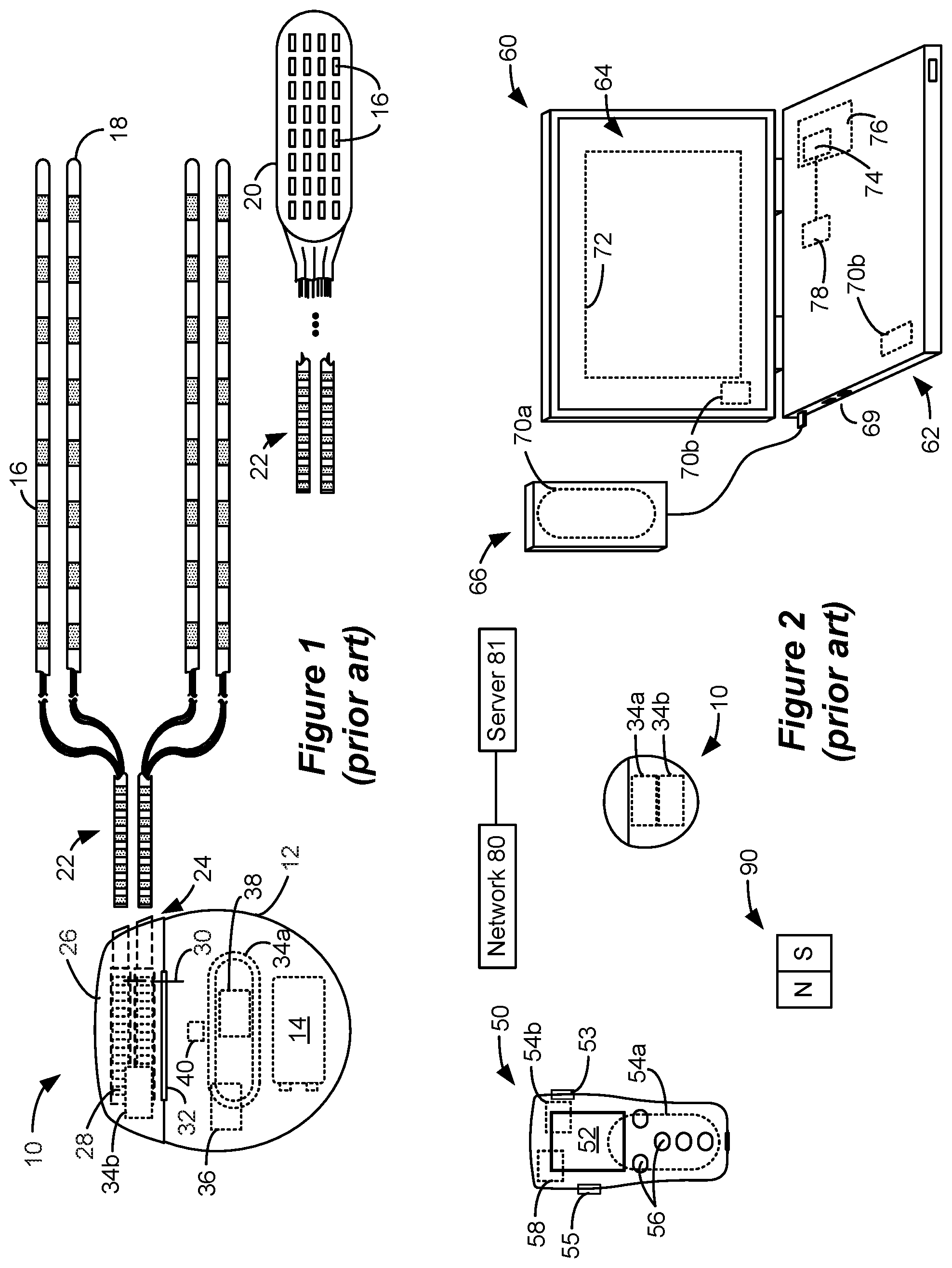 Patent US12101835 Figure 1 – Adjustment of advertising interval in communications between an implantable medical device and an external device