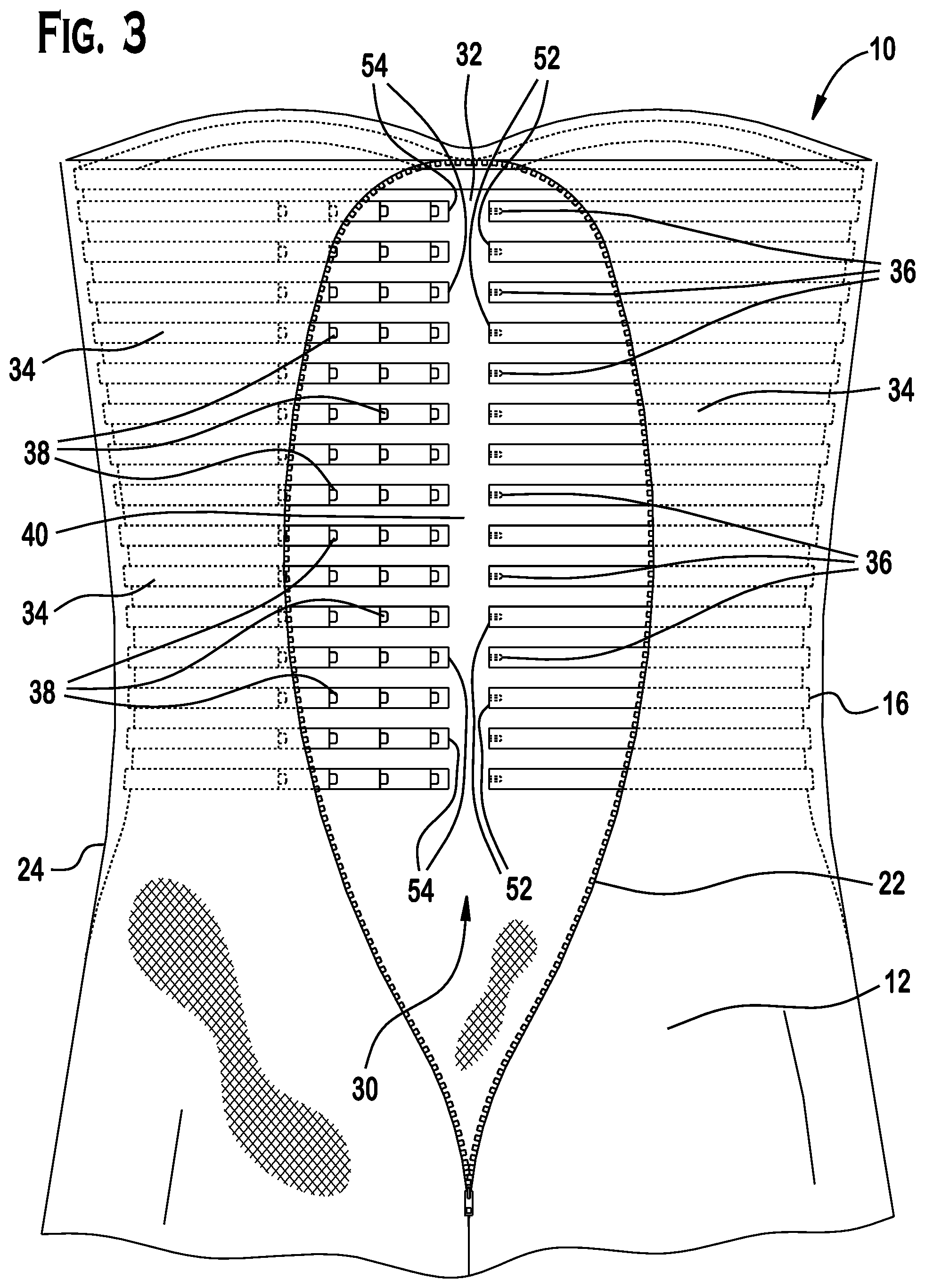 Patent US12102139 Figure 2 – Adjustable intra-clothing device for supporting at least a portion of a torso of a person, an article of clothing for supporting at least a portion of a torso of a person, and an adjustable corset for supporting at least a portion of a torso of a person