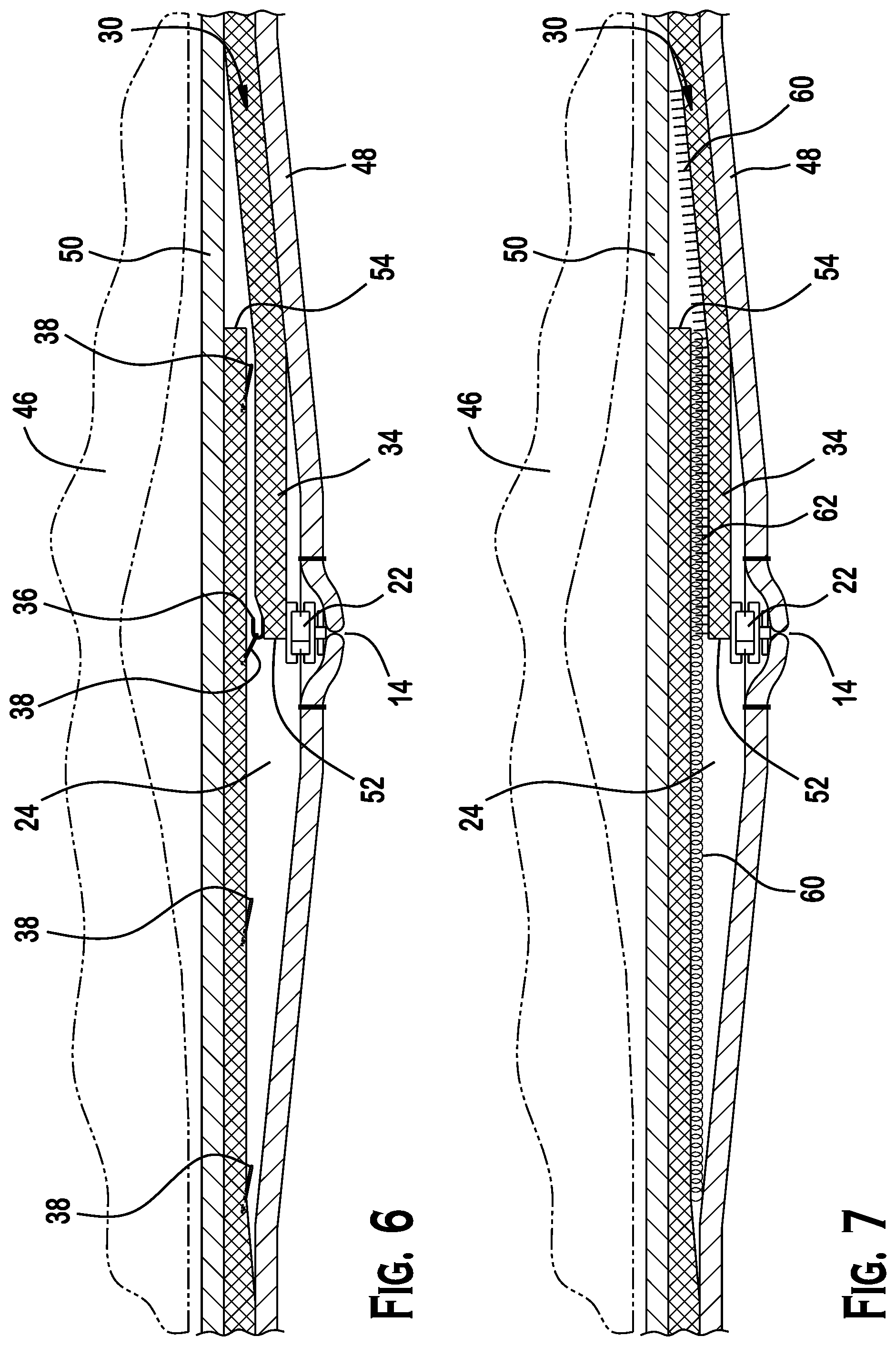 Patent US12102139 Figure 5 – Adjustable intra-clothing device for supporting at least a portion of a torso of a person, an article of clothing for supporting at least a portion of a torso of a person, and an adjustable corset for supporting at least a portion of a torso of a person