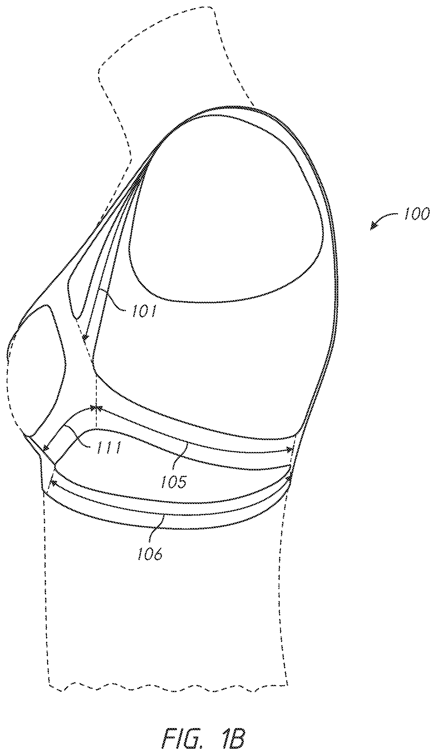 Patent US12102142 Figure 2 – Pressure-distributing undergarment