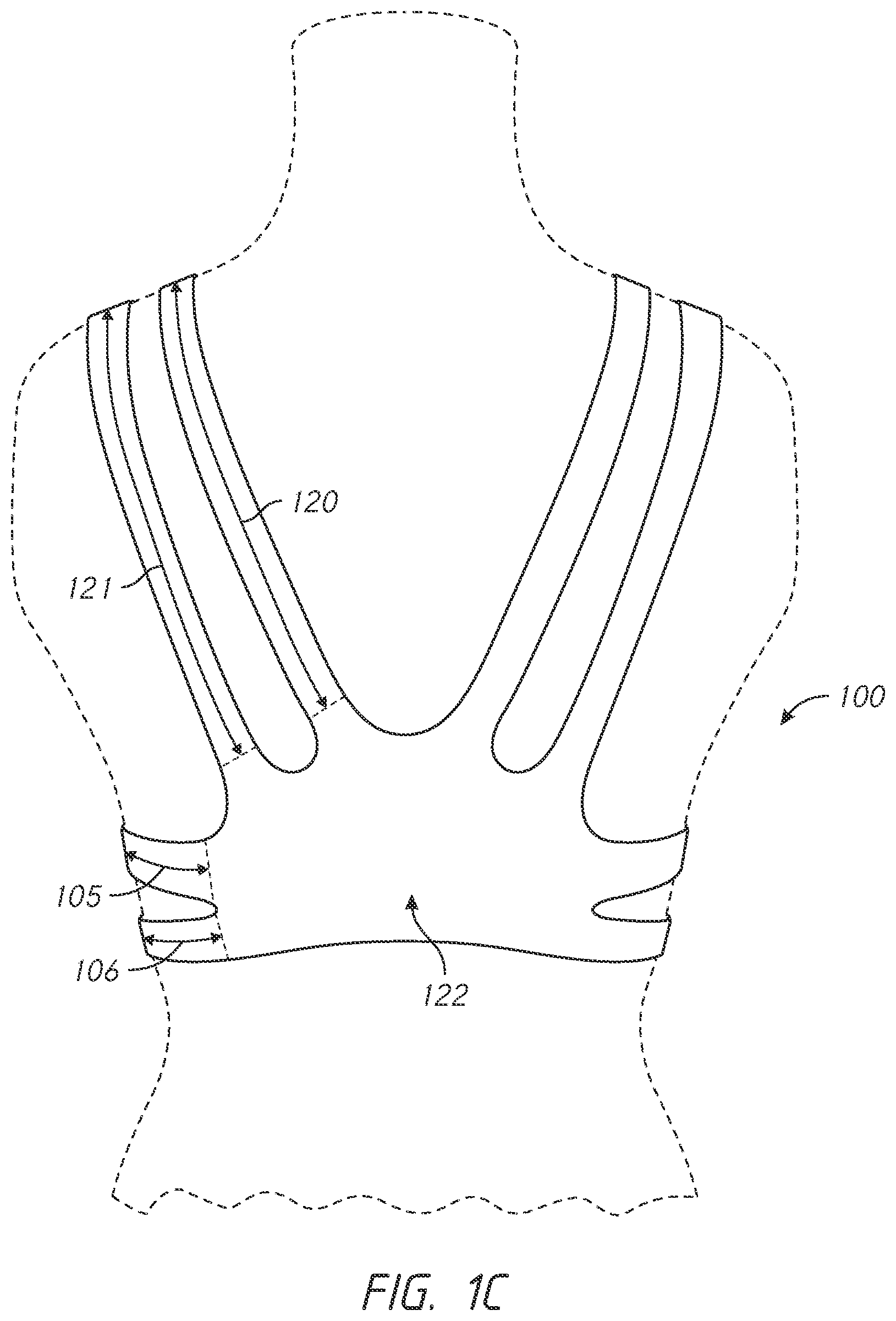 Patent US12102142 Figure 3 – Pressure-distributing undergarment