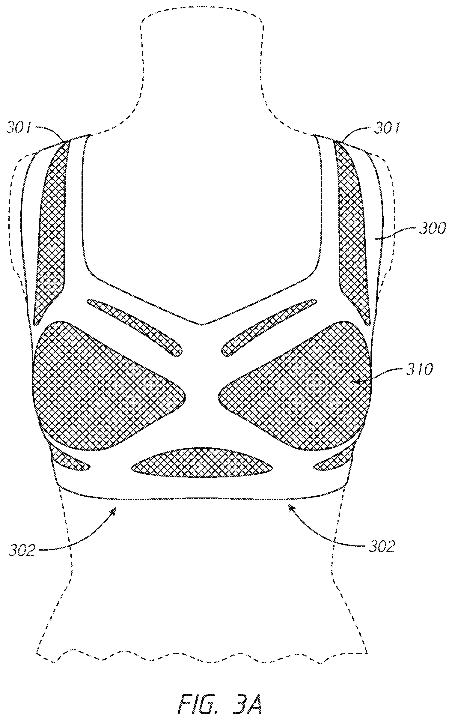 Patent US12102142 Figure 5 – Pressure-distributing undergarment