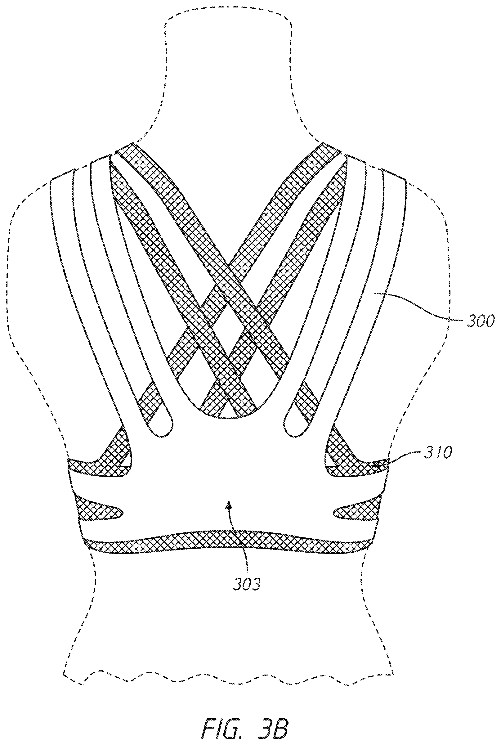 Patent US12102142 Figure 6 – Pressure-distributing undergarment