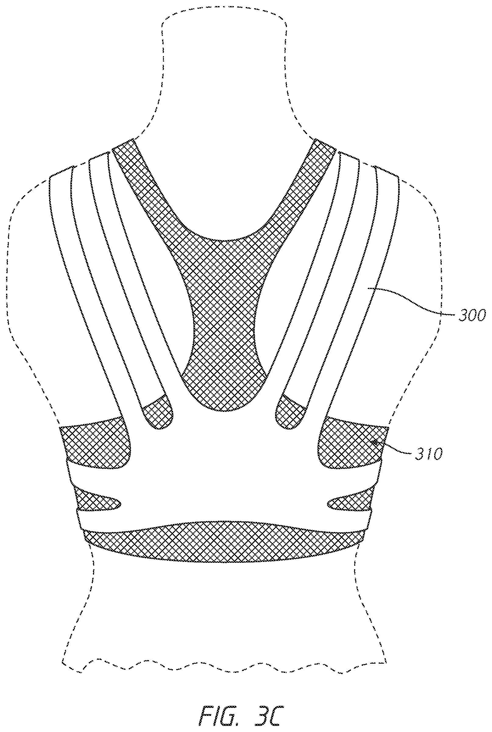 Patent US12102142 Figure 7 – Pressure-distributing undergarment