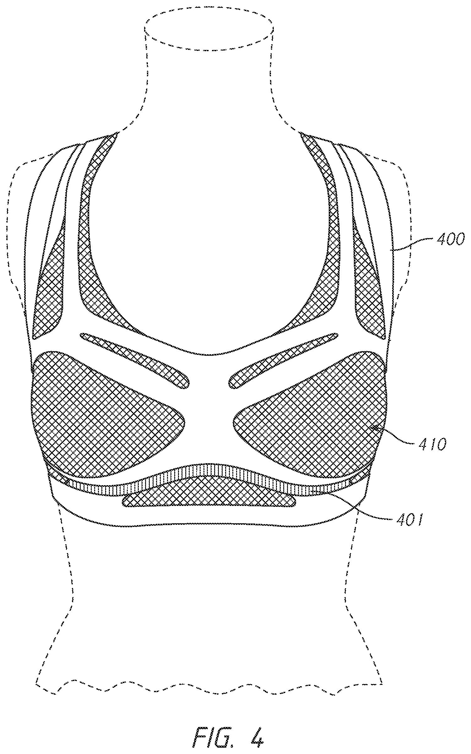 Patent US12102142 Figure 8 – Pressure-distributing undergarment