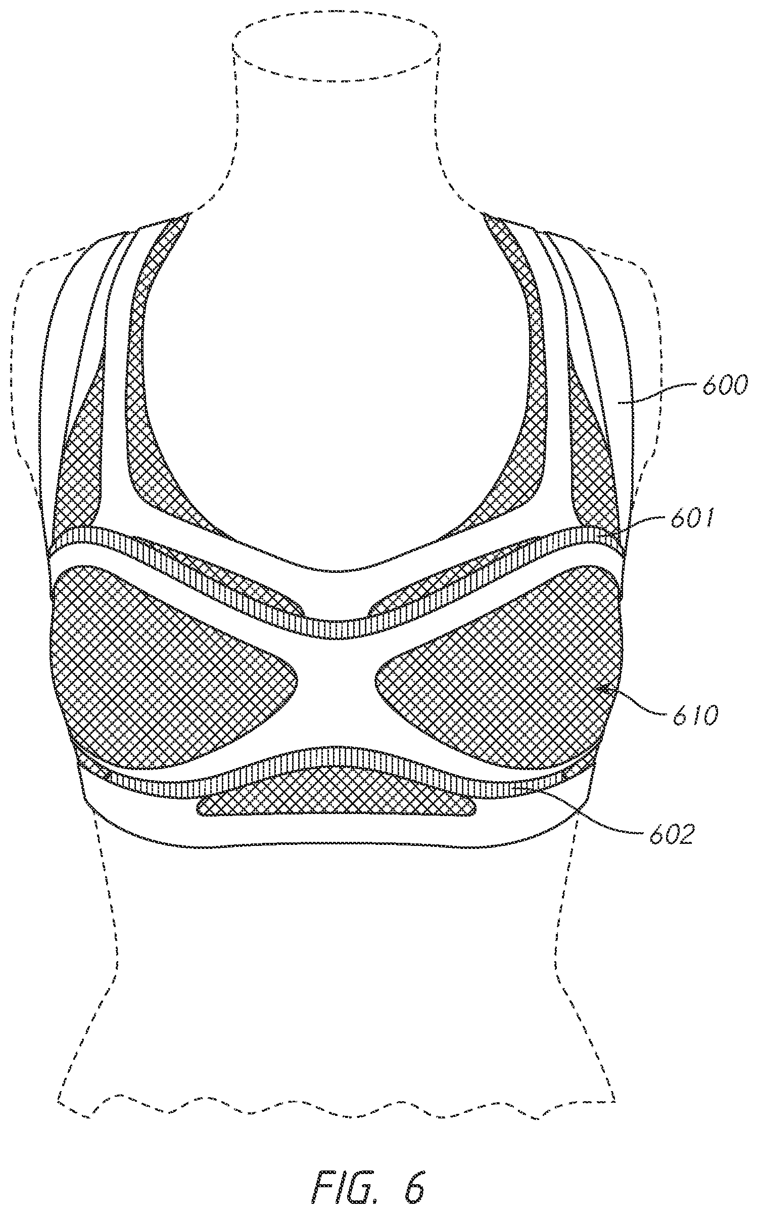 Patent US12102142 Figure 10 – Pressure-distributing undergarment