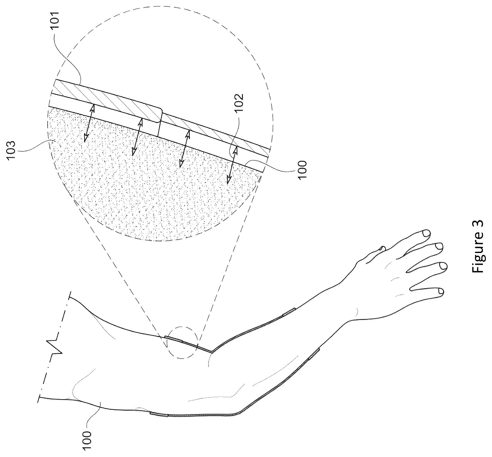 Patent US12102145 Figure 3 – Material and apparel that positively affect the health and wellbeing of a mammal