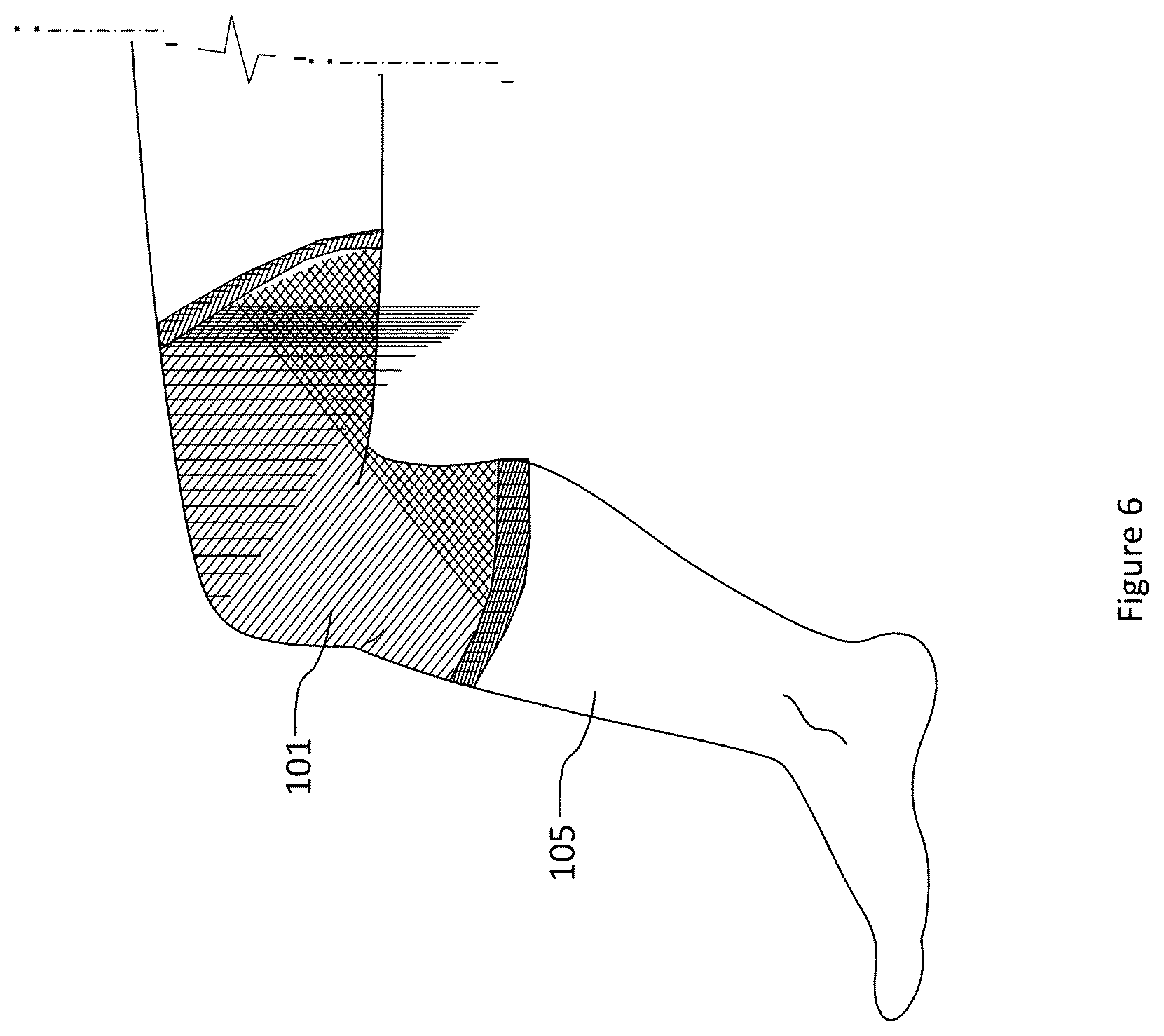 Patent US12102145 Figure 6 – Material and apparel that positively affect the health and wellbeing of a mammal