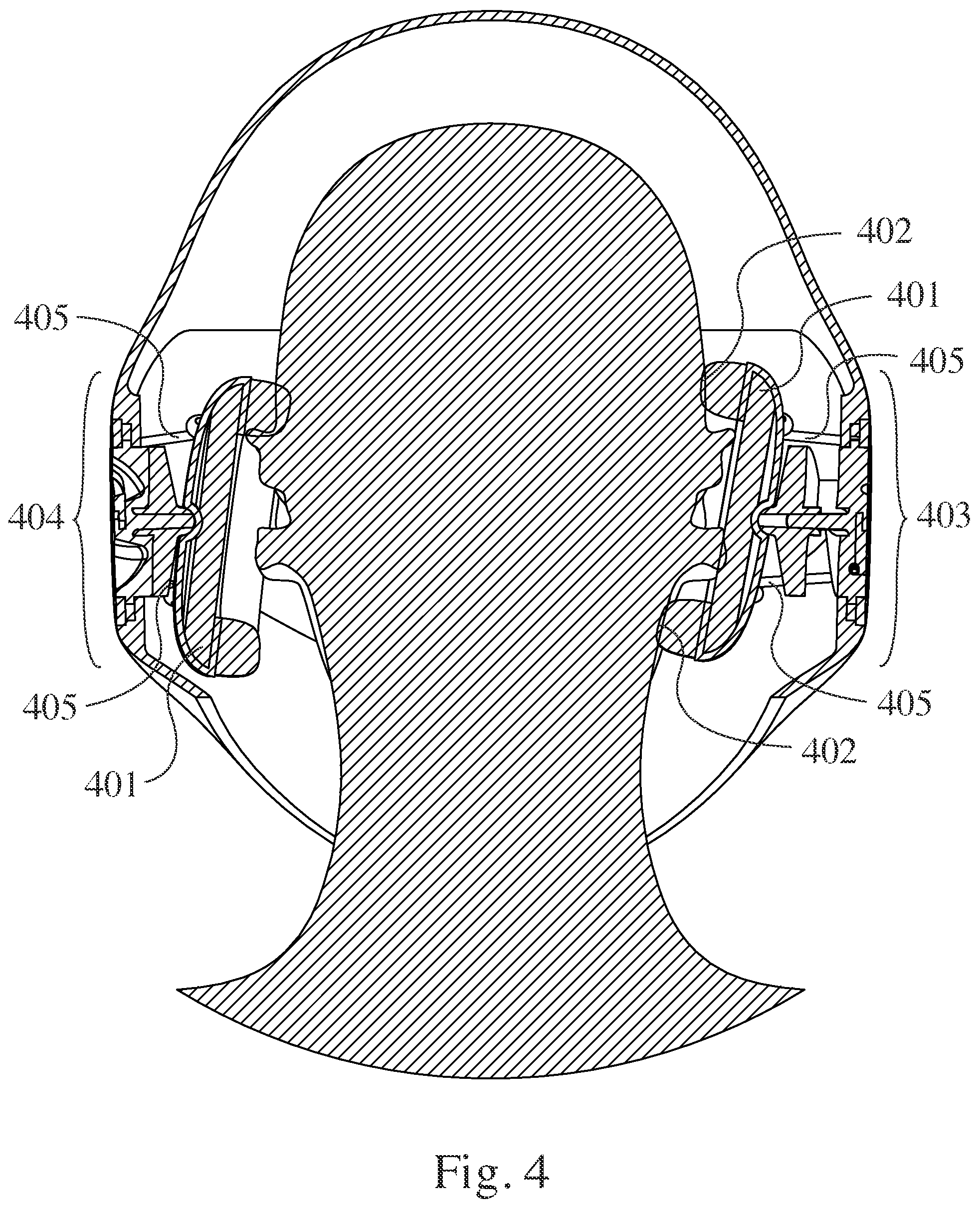 Patent US12102161 Figure 4 – Helmet sound management mechanism