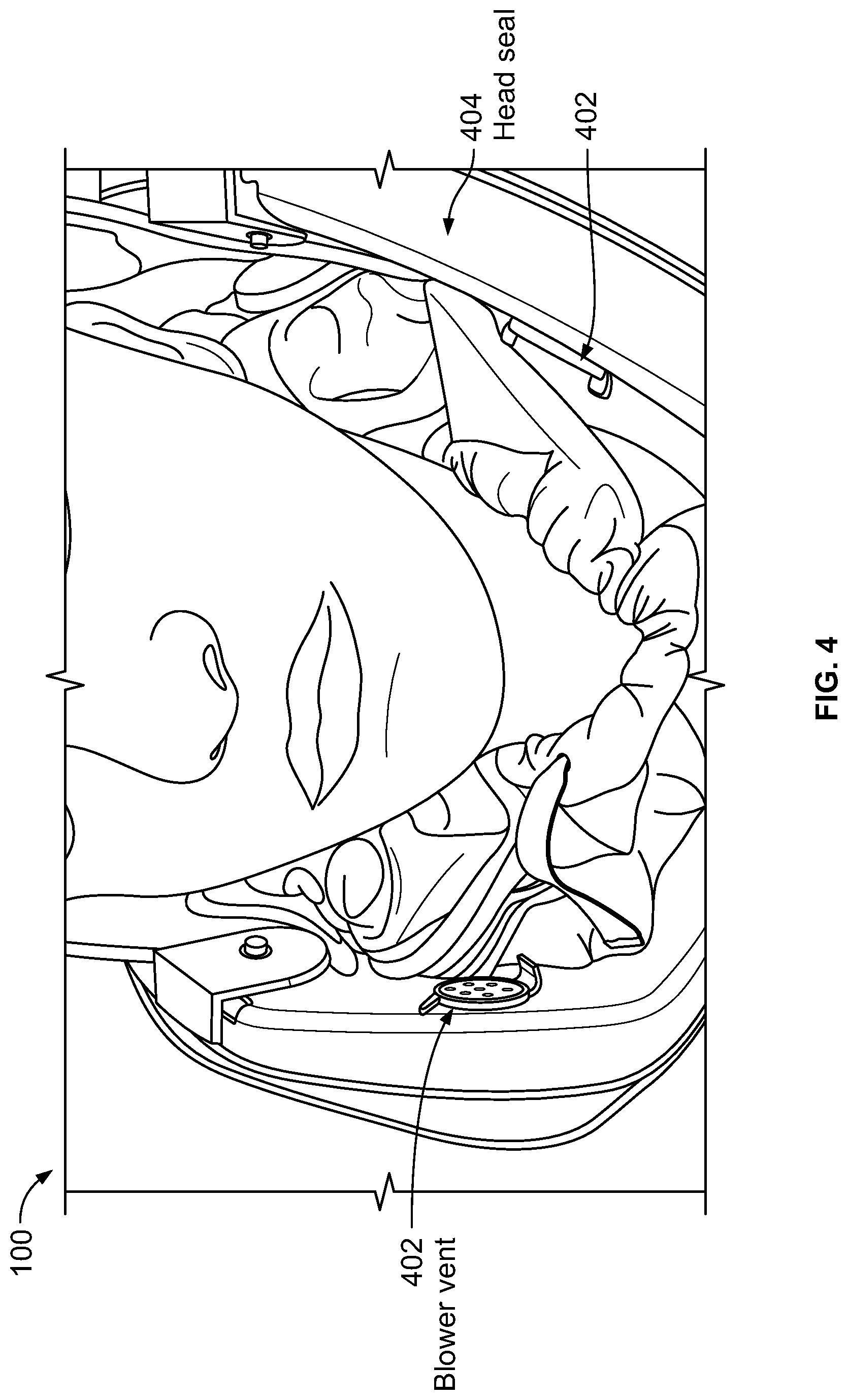 Patent US12102162 Figure 4 – Method and apparatus for head protection and providing air flow