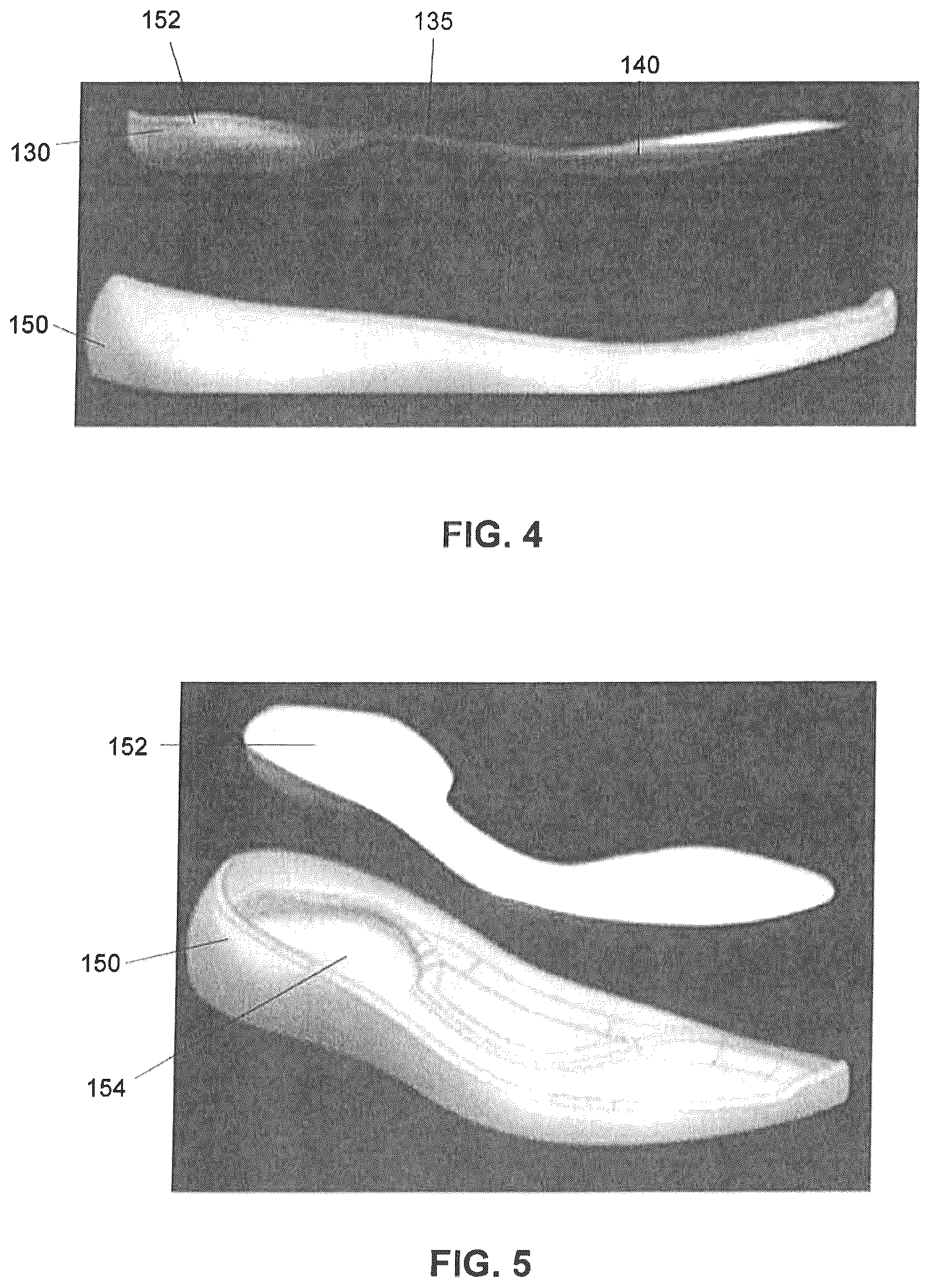 Patent US12102170 Figure 4 – Article of footwear with midsole having variable stiffness