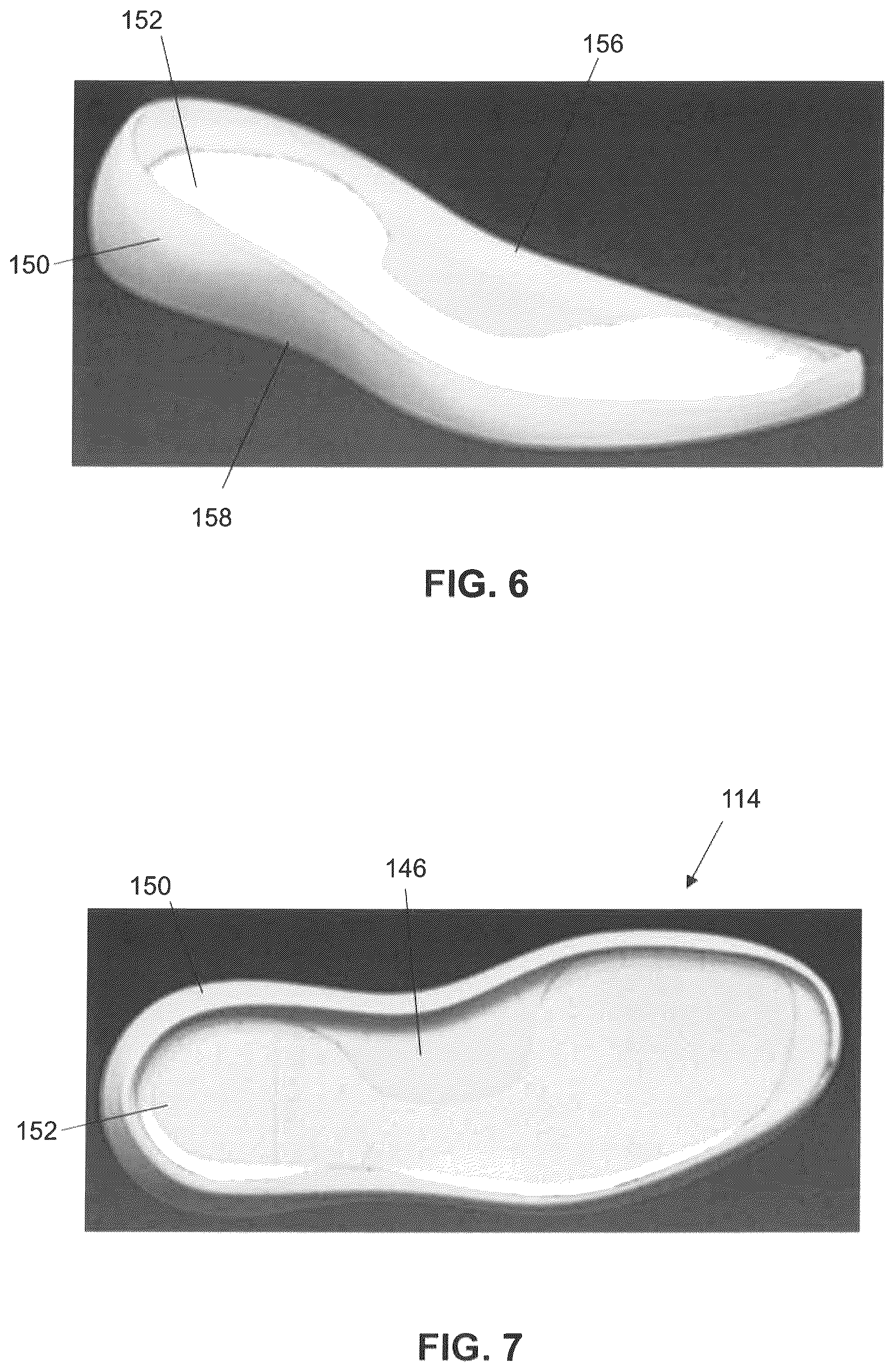 Patent US12102170 Figure 5 – Article of footwear with midsole having variable stiffness