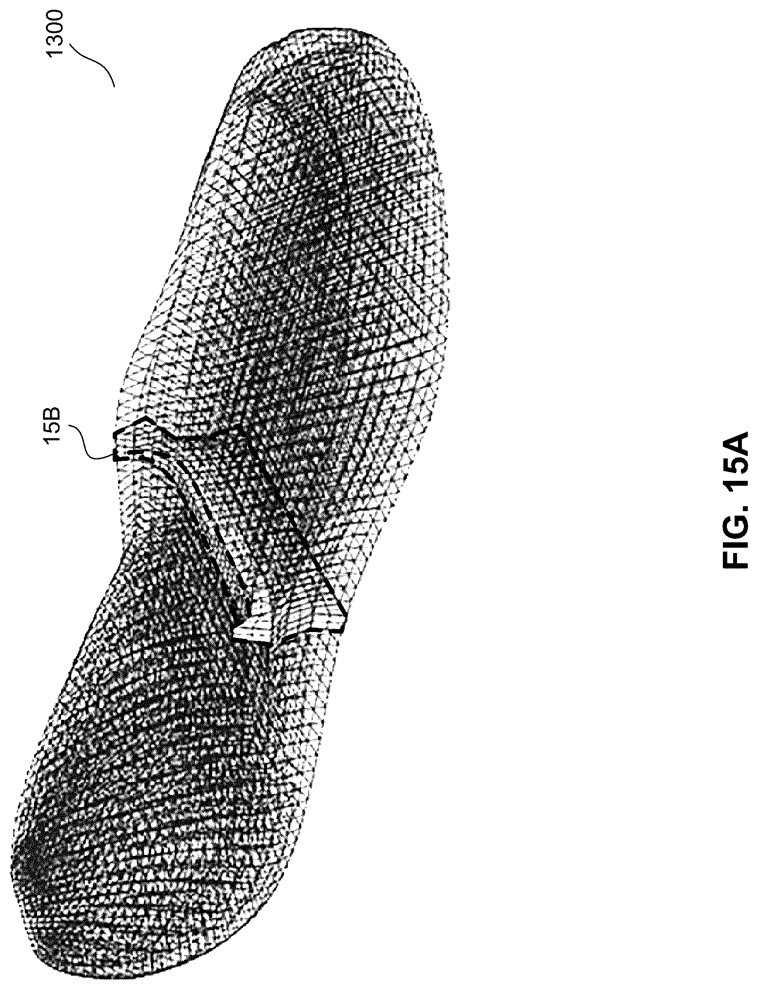 Patent US12102172 Figure 17 – Footwear midsole with warped lattice structure and method of making the same