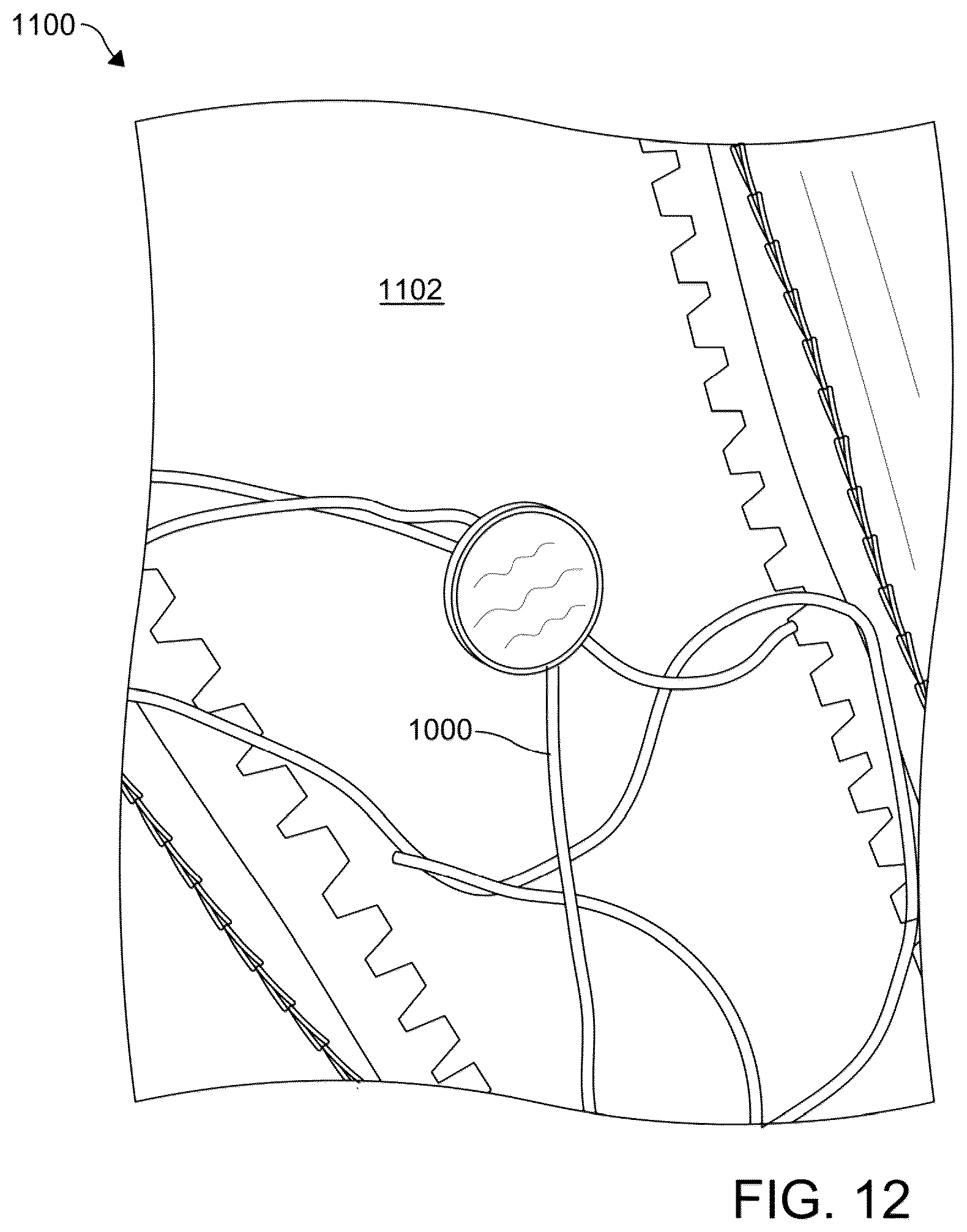 Patent US12102179 Figure 13 – Separable and regenerative footwear