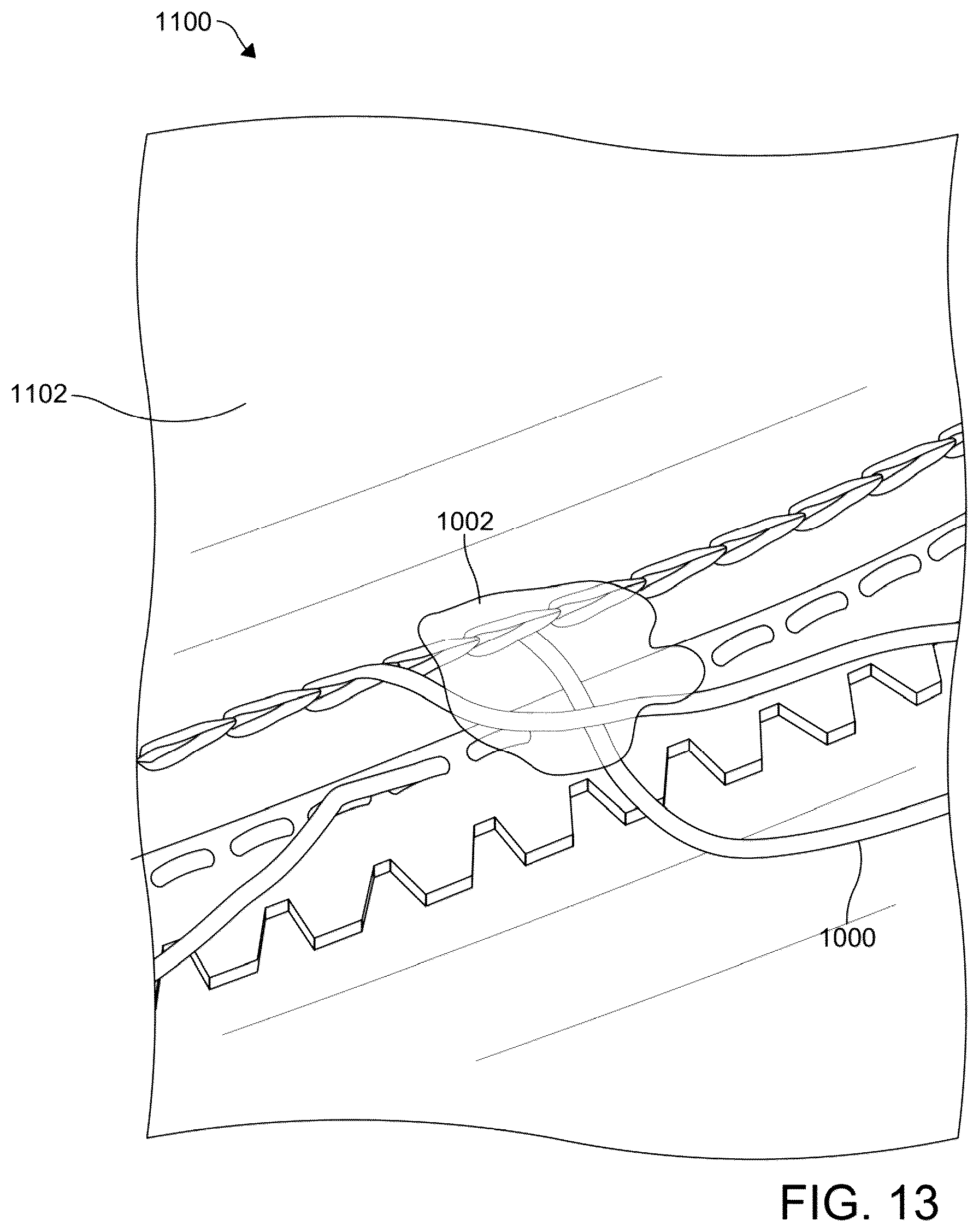 Patent US12102179 Figure 14 – Separable and regenerative footwear