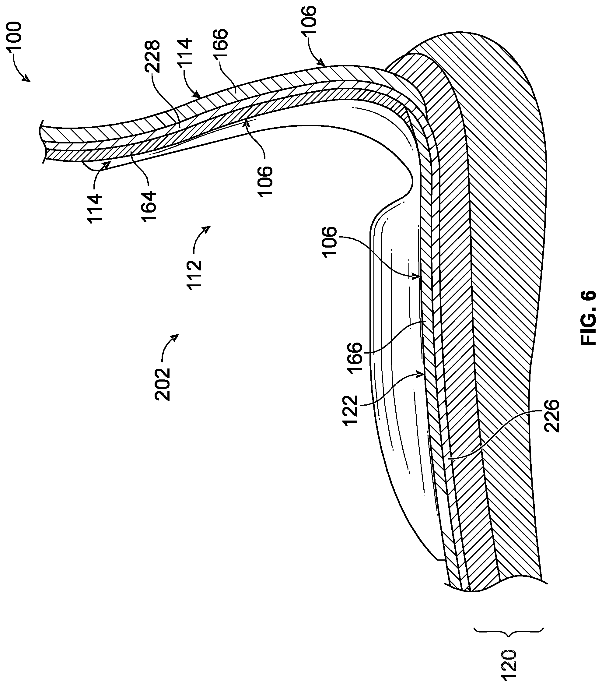 Patent US12102184 Figure 6 – Footwear heel insert
