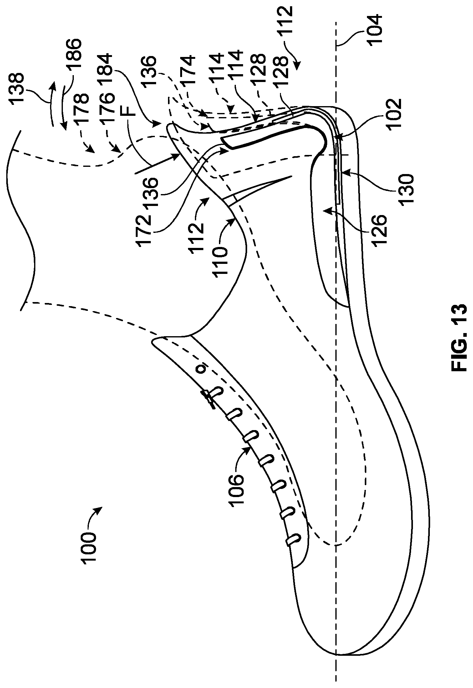 Patent US12102184 Figure 12 – Footwear heel insert