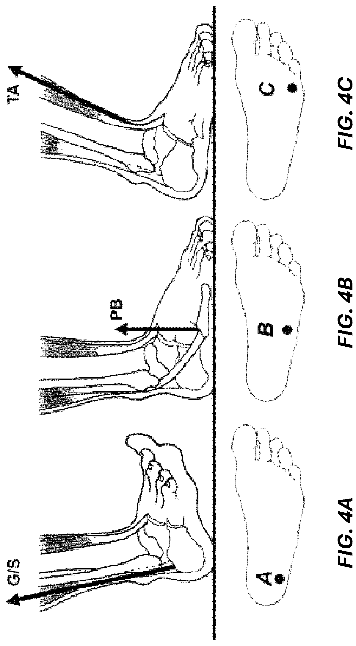 Patent US12102186 Figure 4 – Cuboid inserts for improving balance and preventing falls