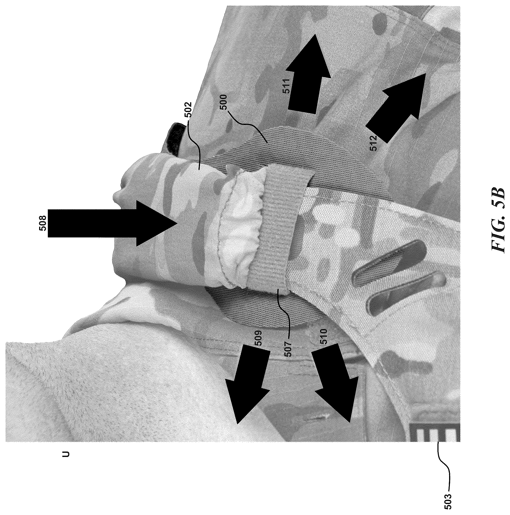 Patent US12102215 Figure 4 – High mobility contoured pad