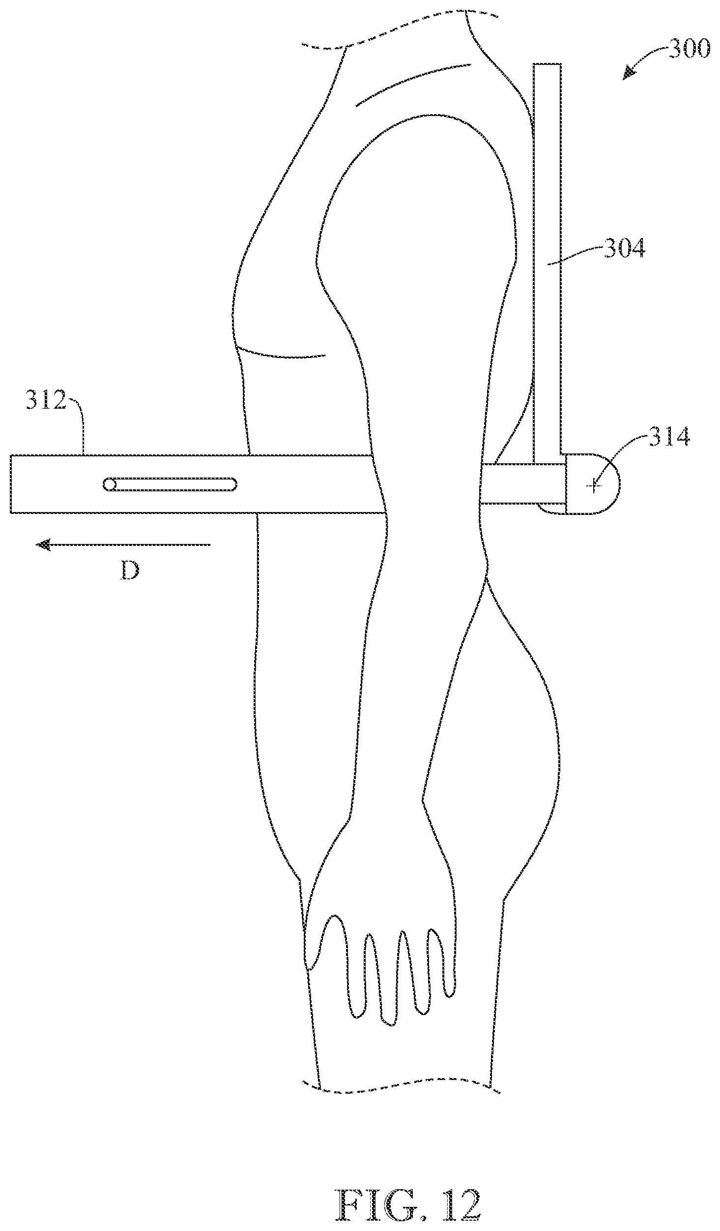 Patent US12102218 Figure 12 – Wearable support assembly for carrying an electronic device or other item in a functional position
