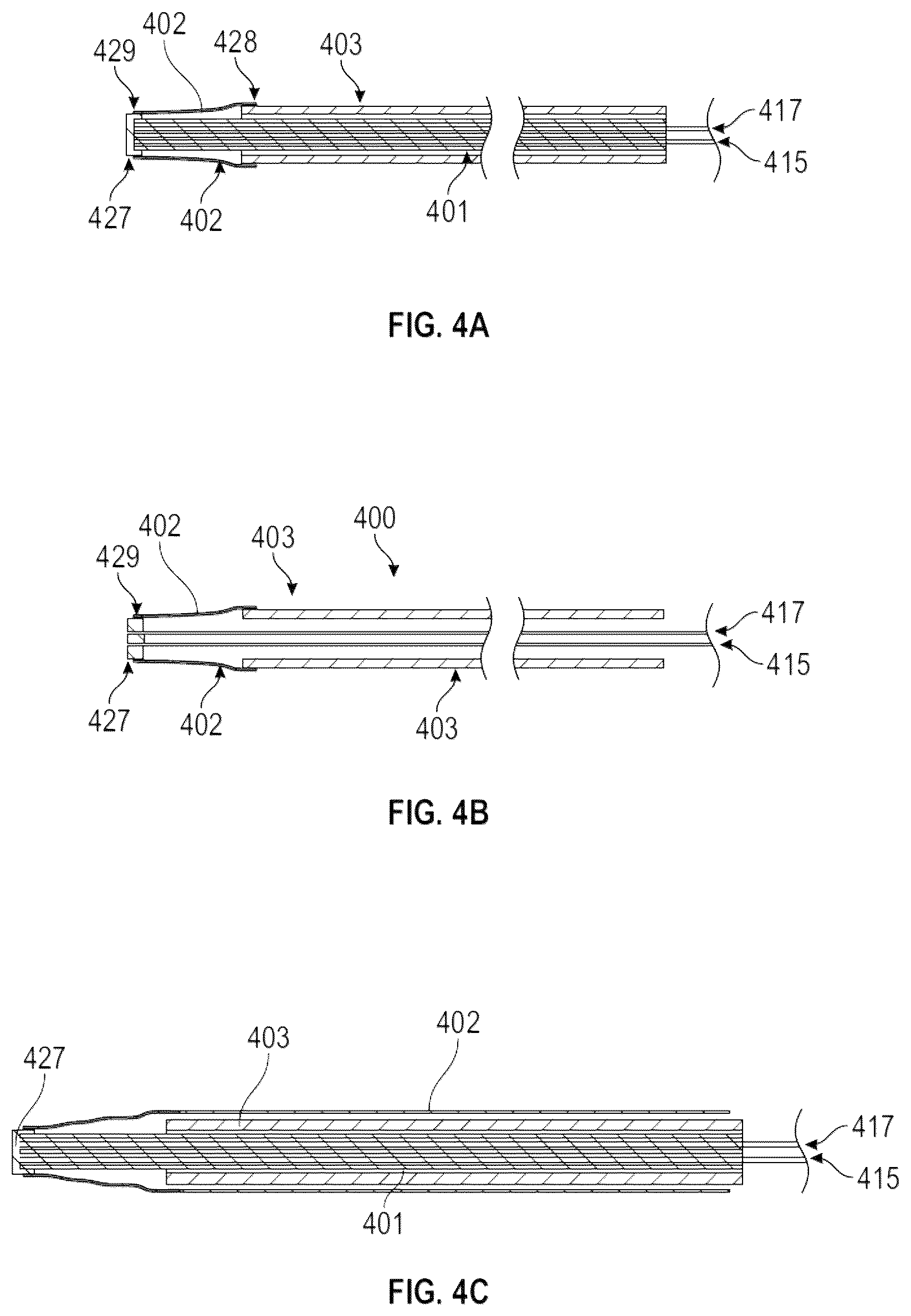 Patent US12102289 Figure 3 – Methods of attaching a rigidizing sheath to an endoscope