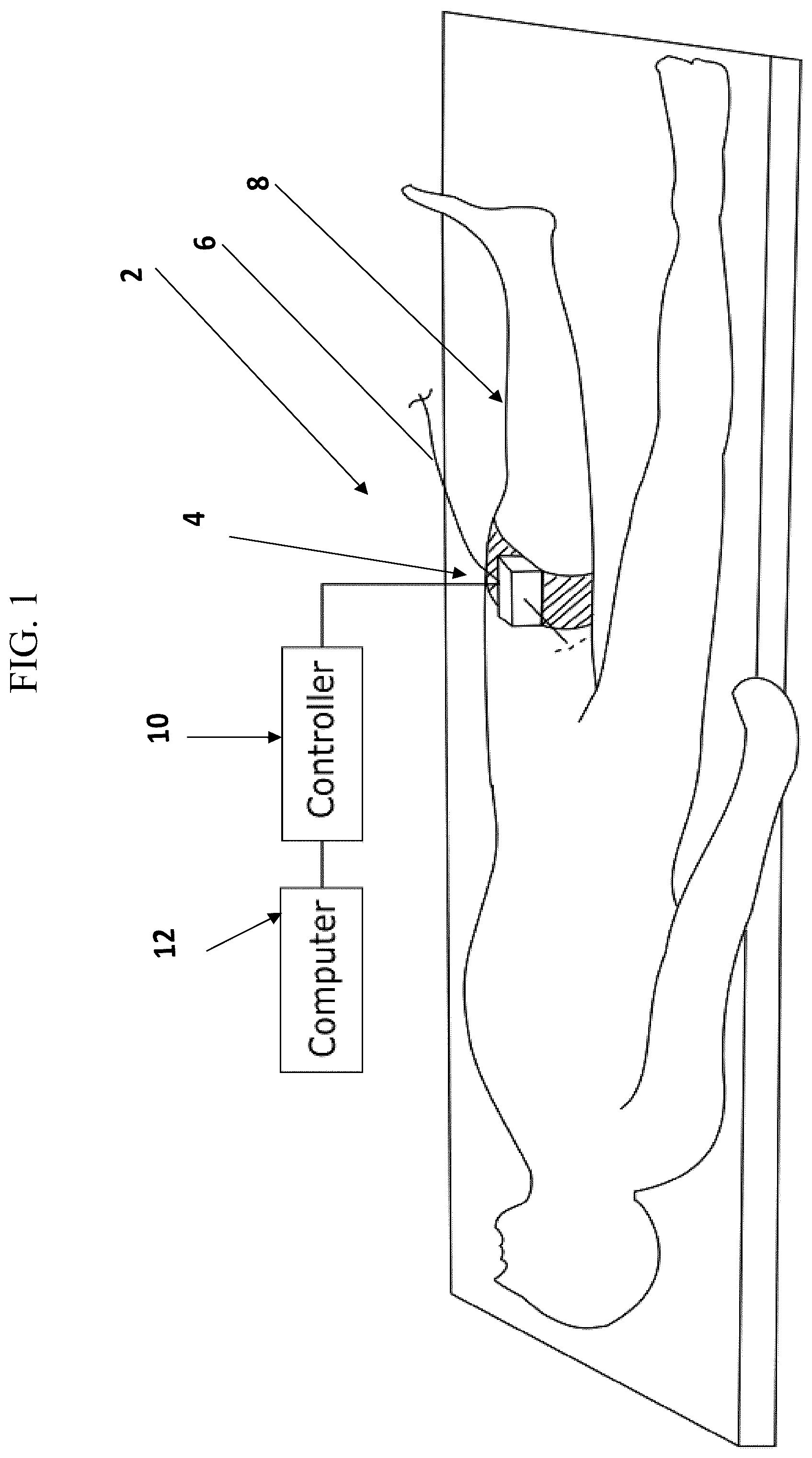 Patent US12102290 Figure 1 – Device for automatically inserting and manipulating a medical tool into and within a bodily lumen