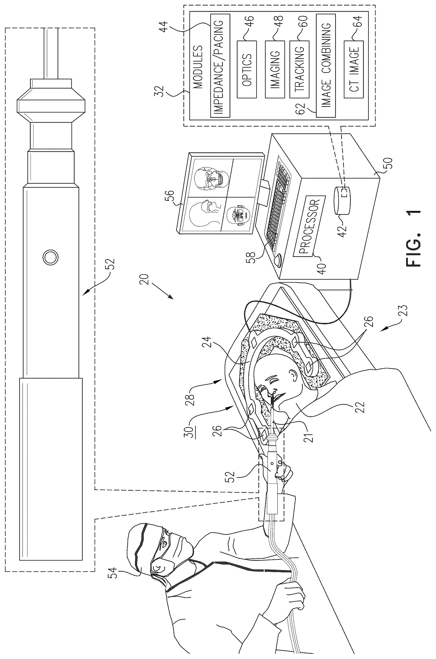 Patent US12102293 Figure 1 – ENT guidewire