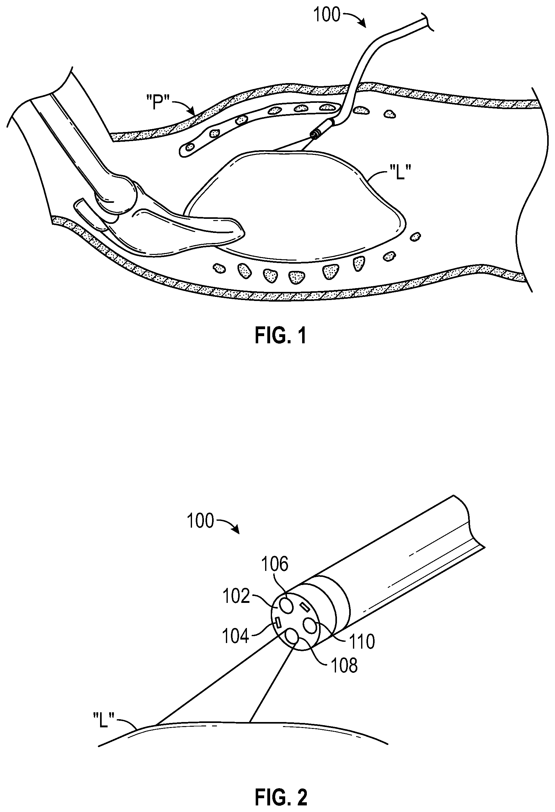 Patent US12102298 Figure 1 – Lymphatic system tracking