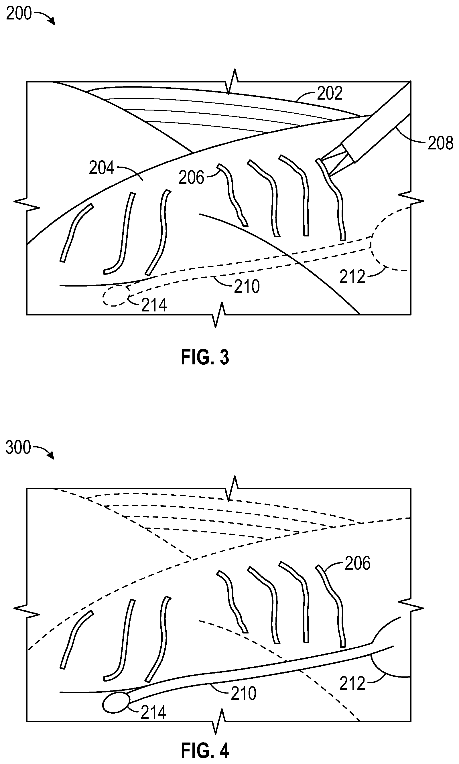 Patent US12102298 Figure 2 – Lymphatic system tracking