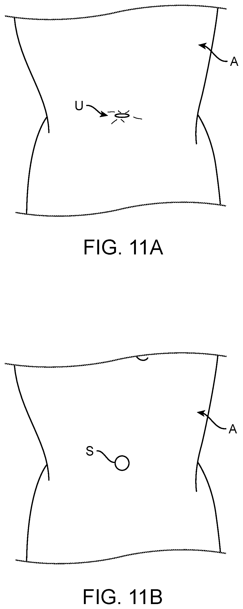 Patent US12102302 Figure 10 – Methods and systems for robotic single-port laparoscopic access