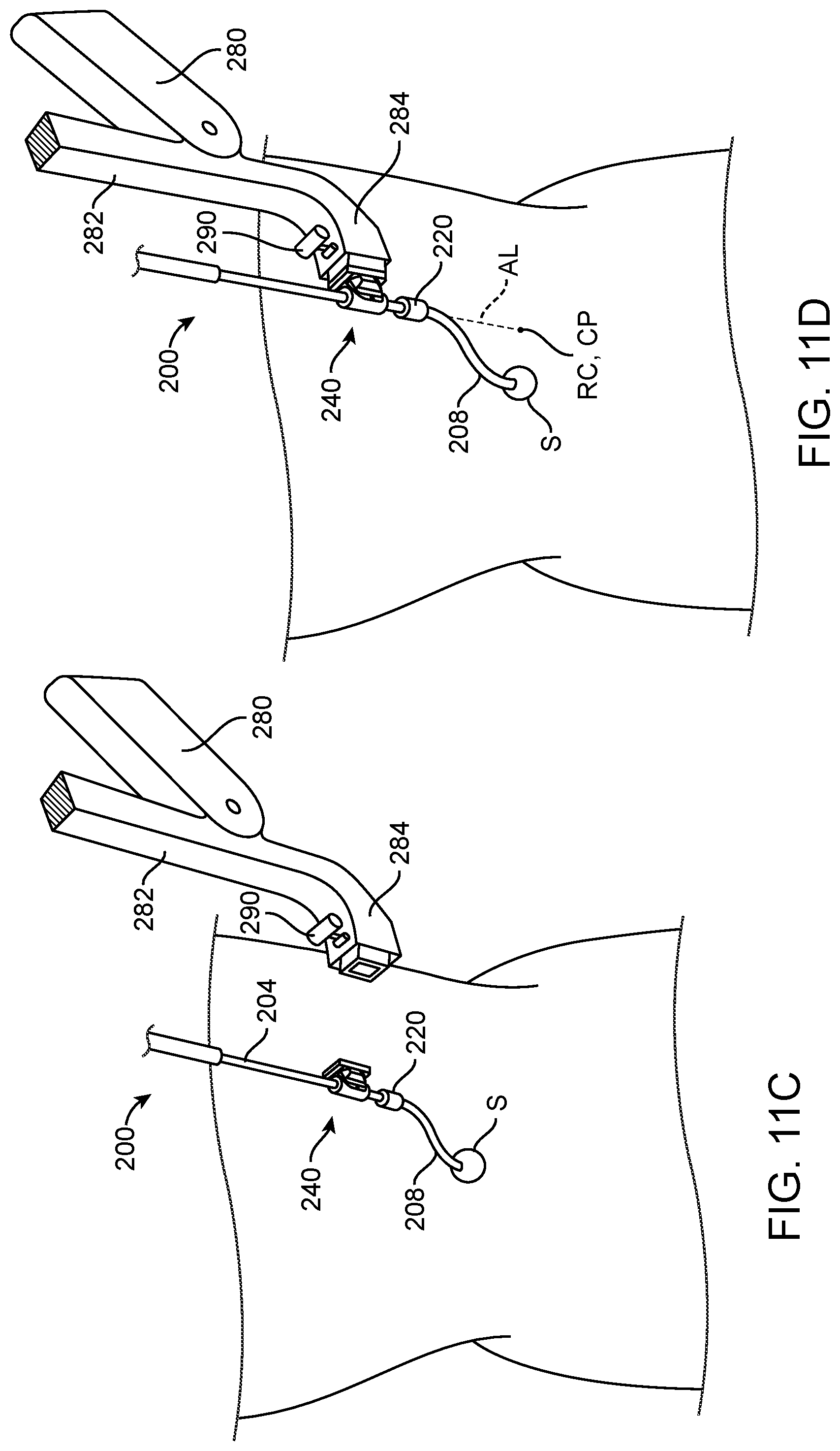 Patent US12102302 Figure 11 – Methods and systems for robotic single-port laparoscopic access