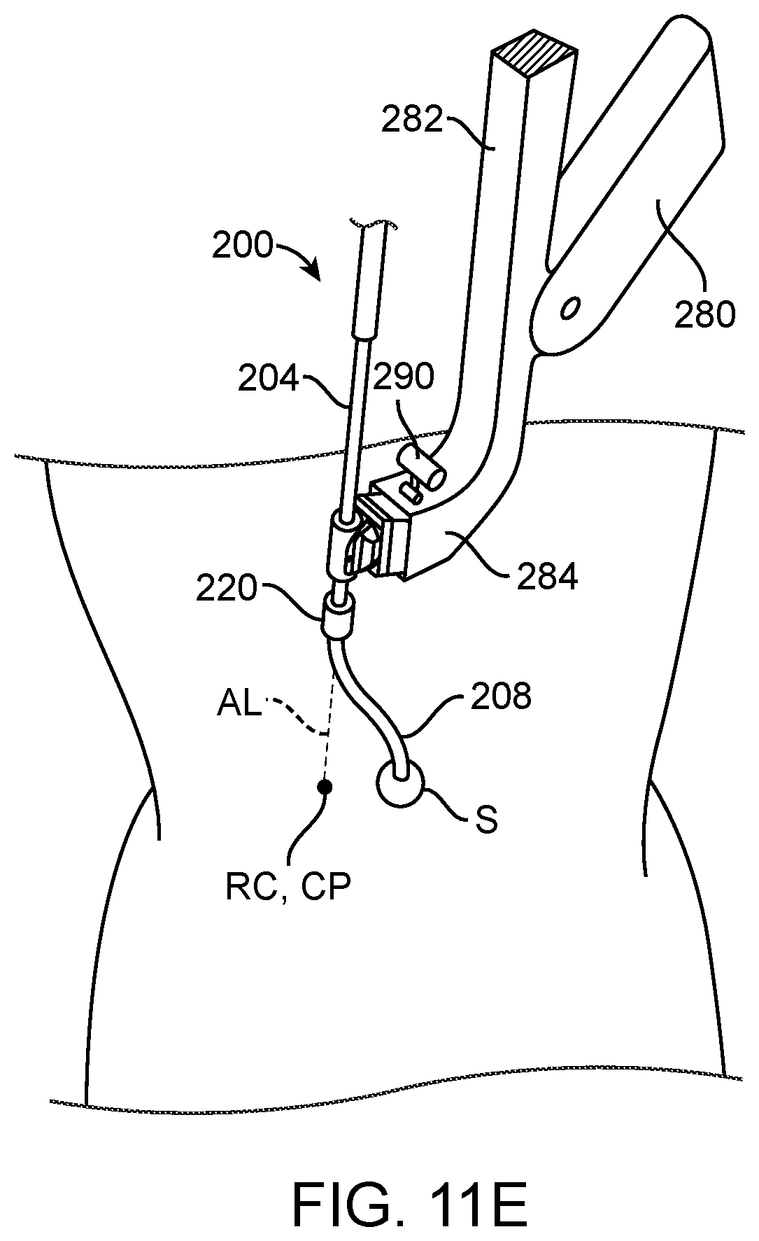 Patent US12102302 Figure 12 – Methods and systems for robotic single-port laparoscopic access