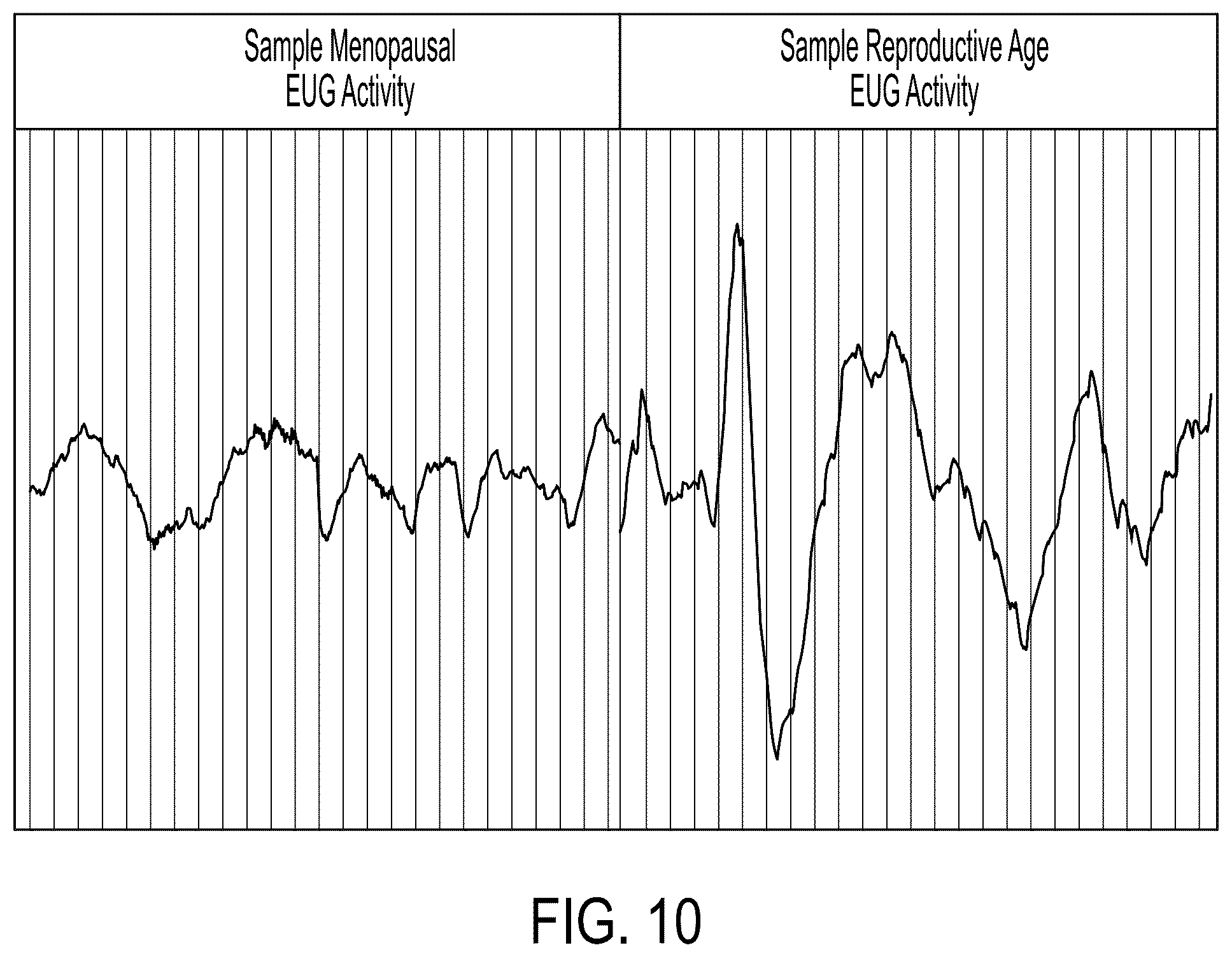 Patent US12102303 Figure 6 – Method and apparatus for direct in-vivo, electrical and chemical monitoring and stimulation of the endometrial cavity