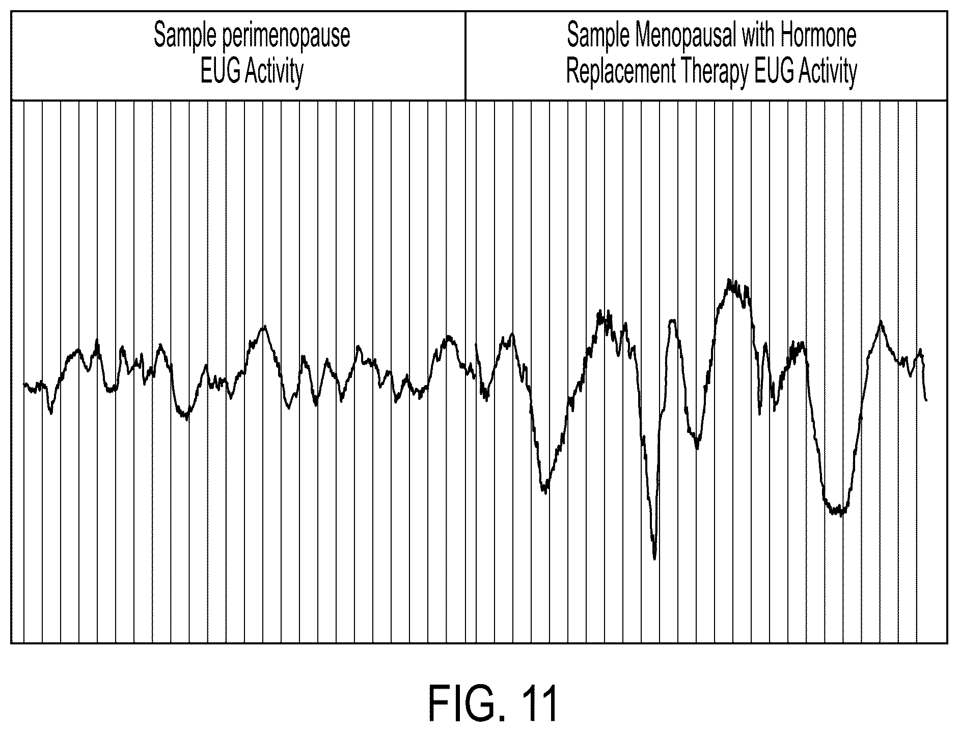 Patent US12102303 Figure 7 – Method and apparatus for direct in-vivo, electrical and chemical monitoring and stimulation of the endometrial cavity